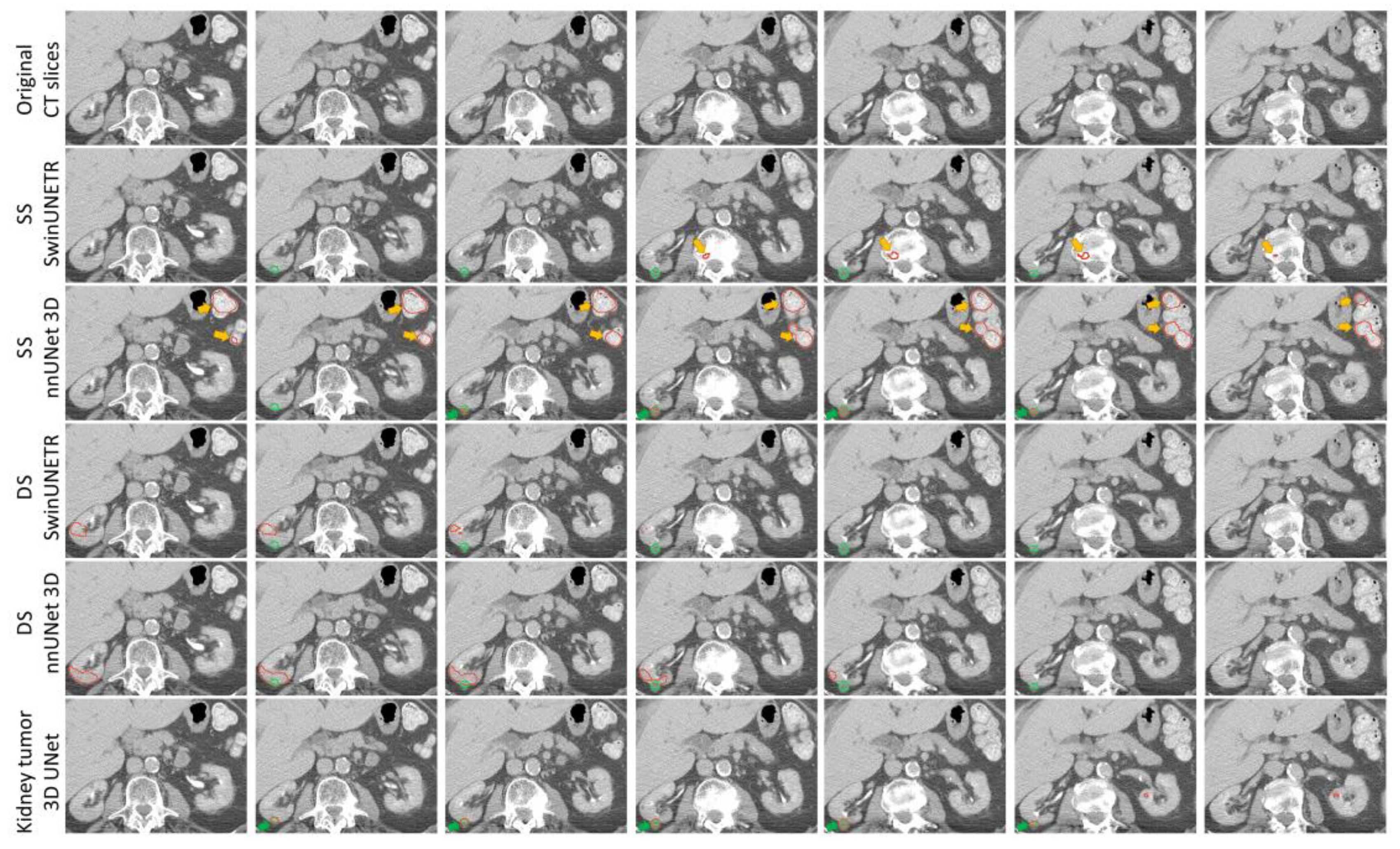 Tomography 11 00003 g006