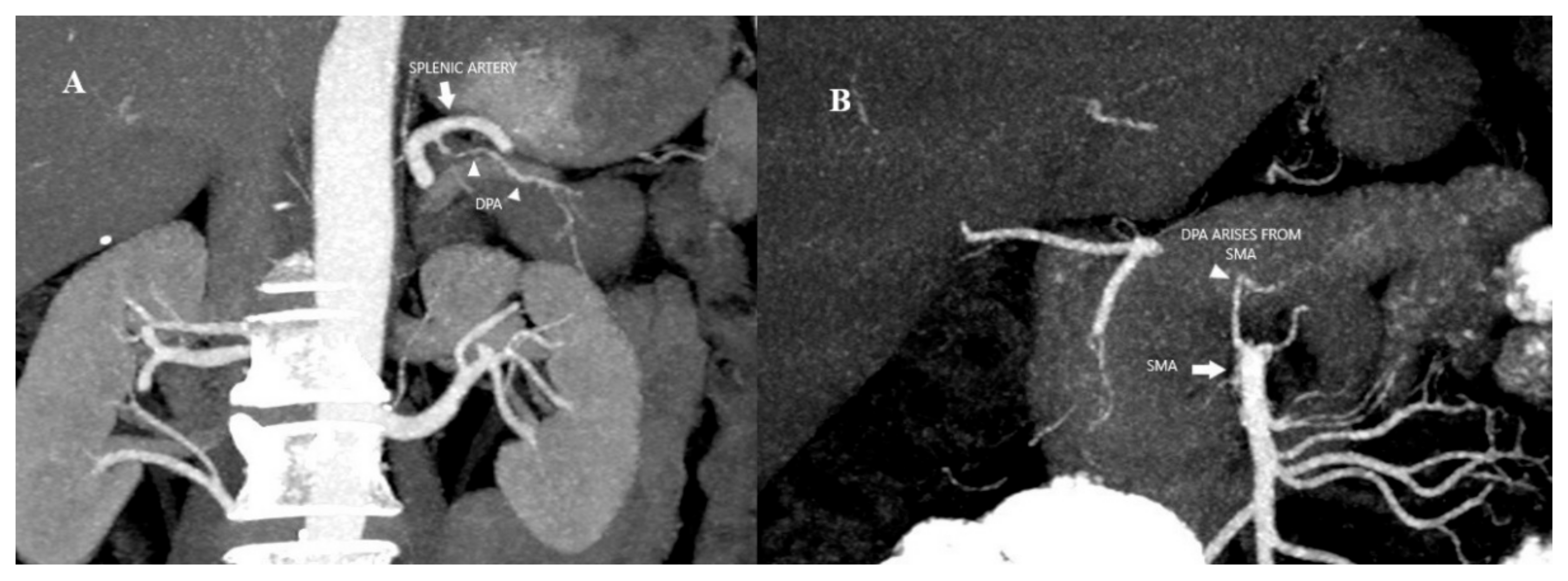 Tomography 11 00009 g001 Tomography 11 00009 g001
