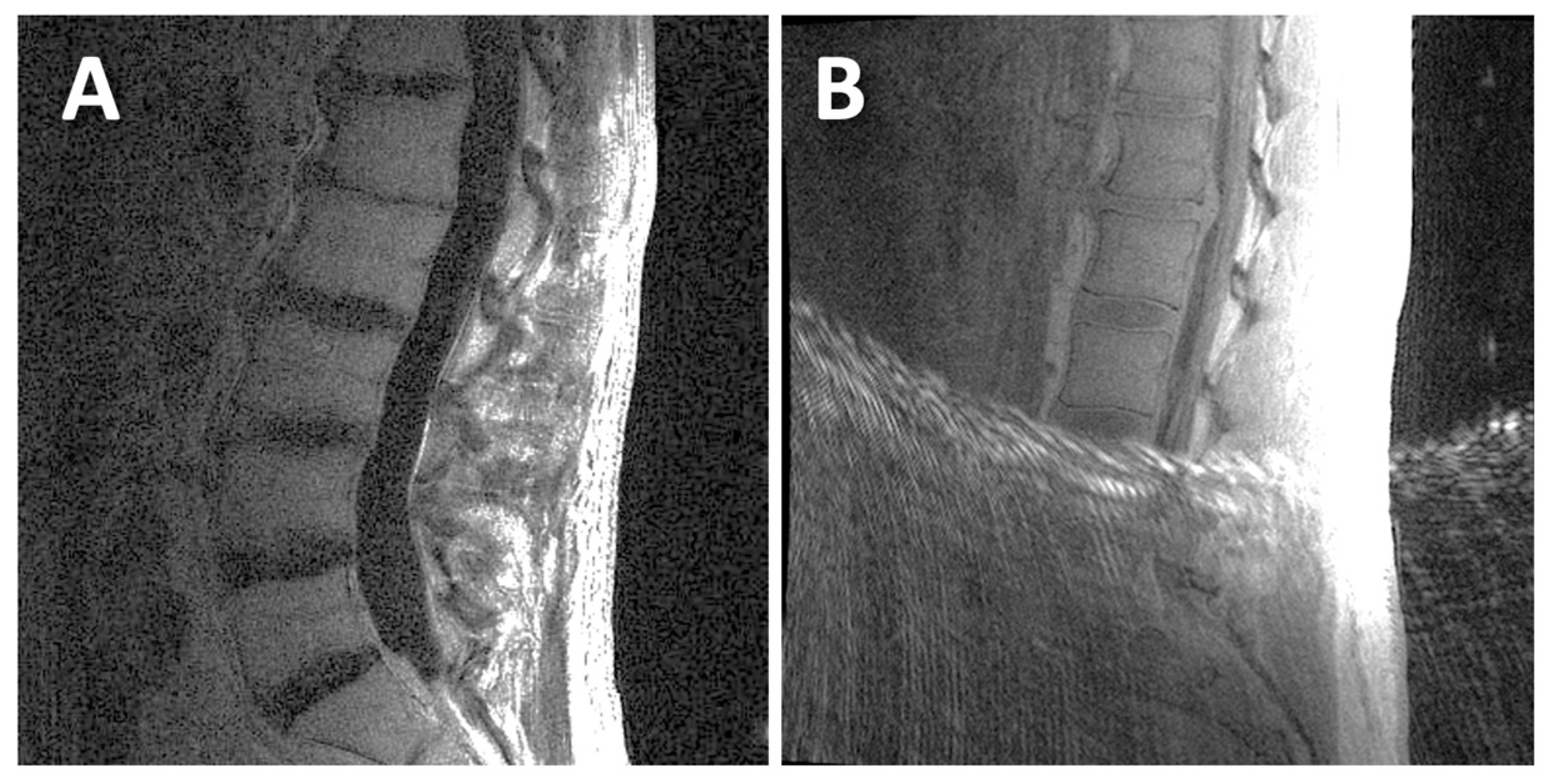 Tomography 11 00012 g002