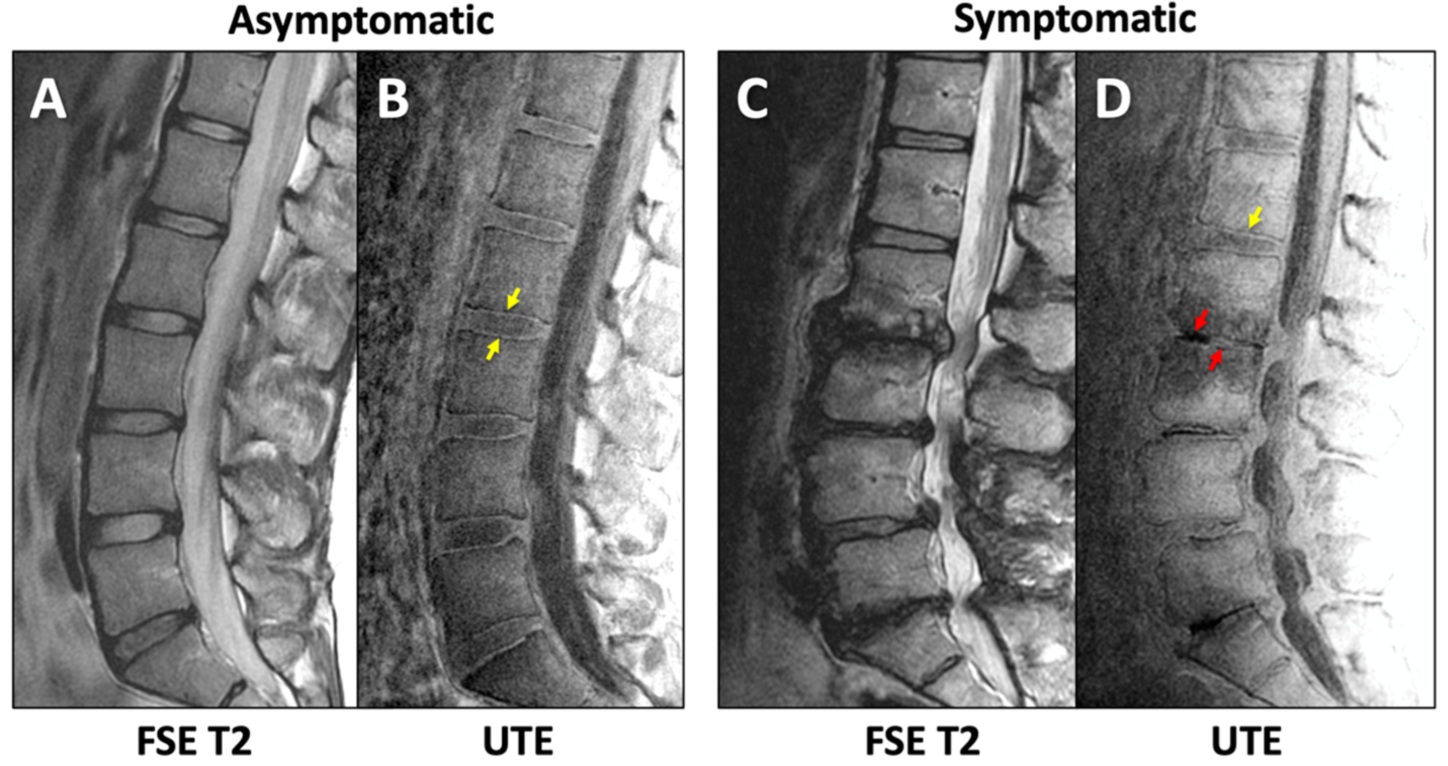 Tomography 11 00012 g005