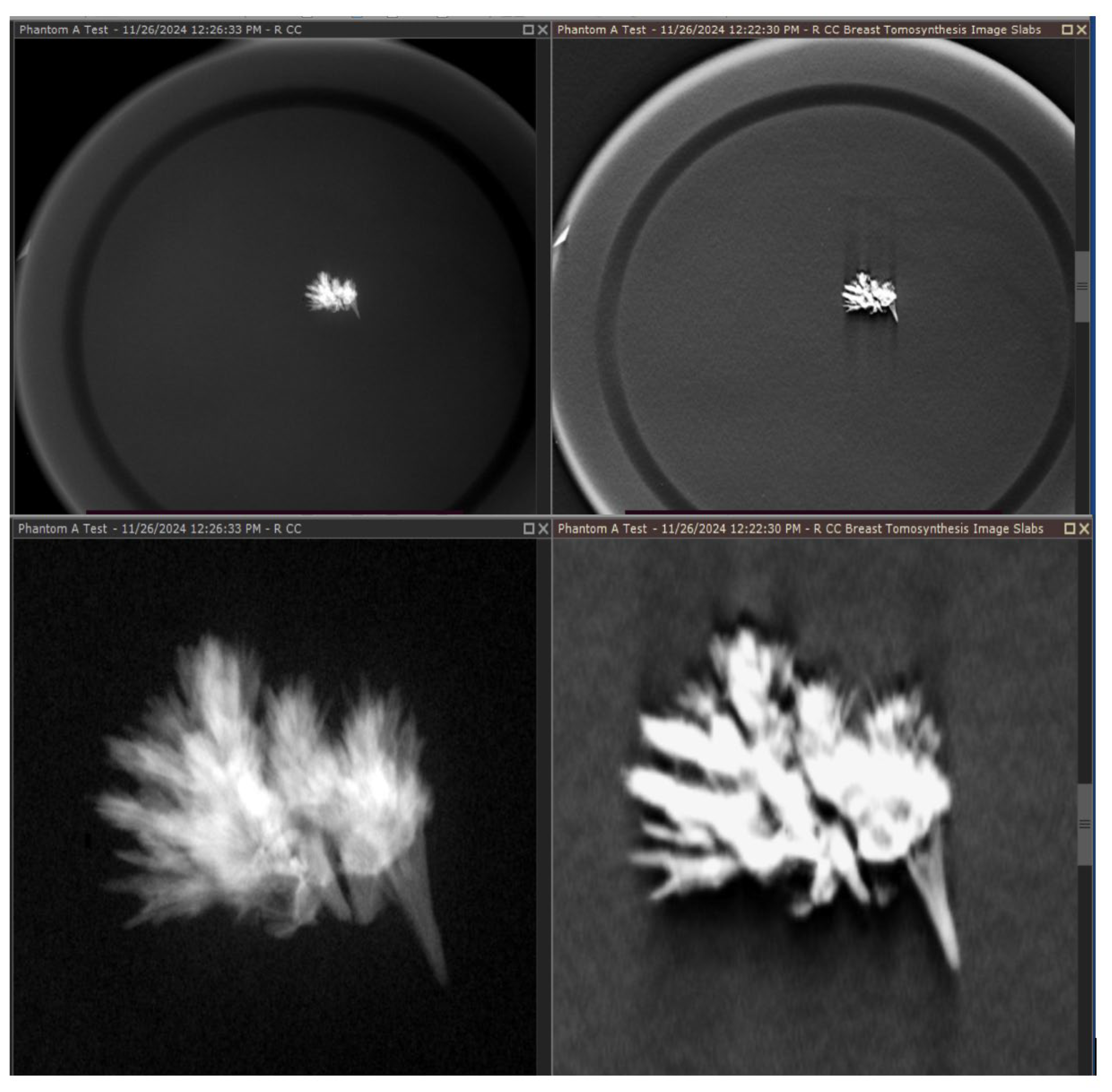 Tomography 11 00025 g010 Tomography 11 00025 g010