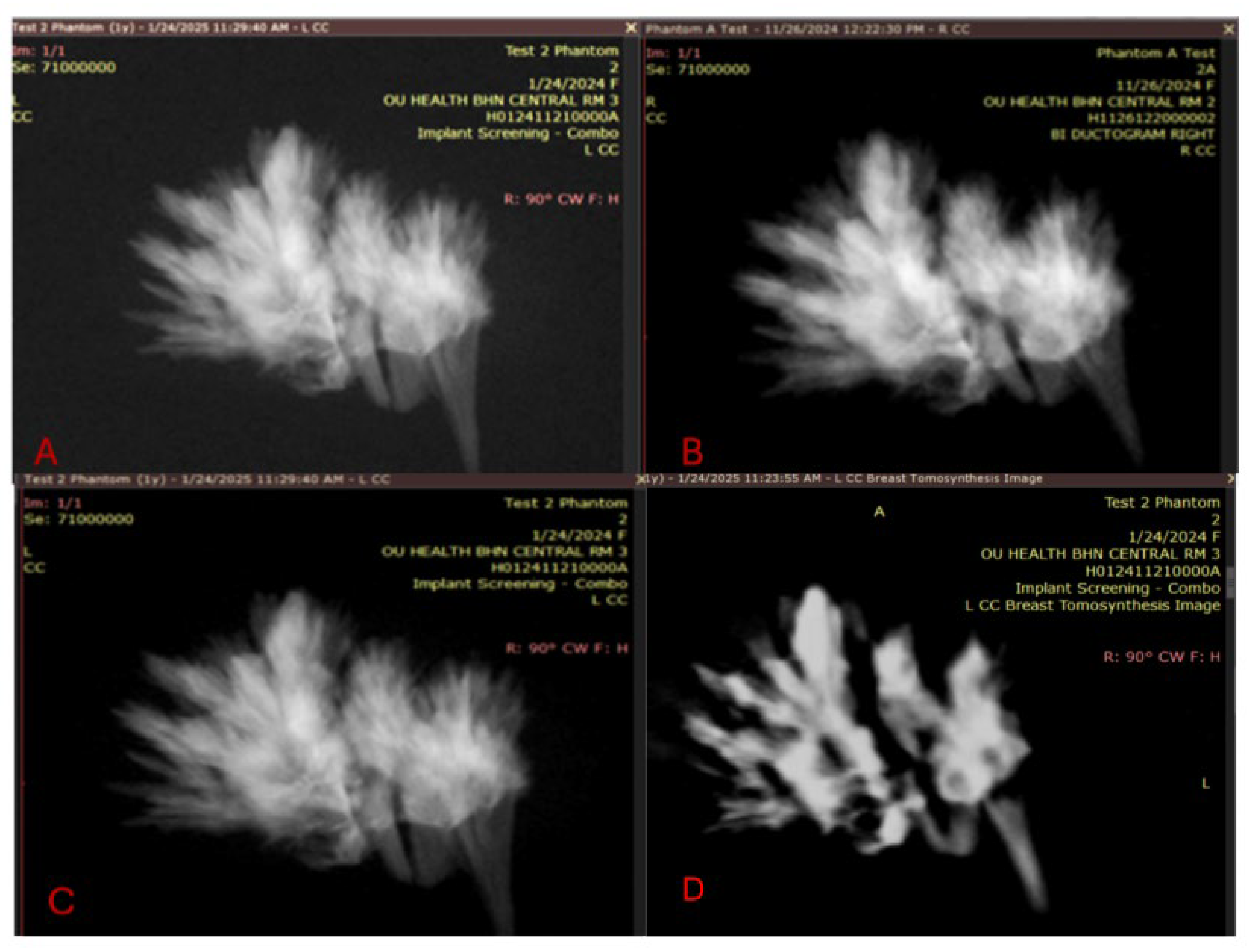 Tomography 11 00025 g011a Tomography 11 00025 g011a