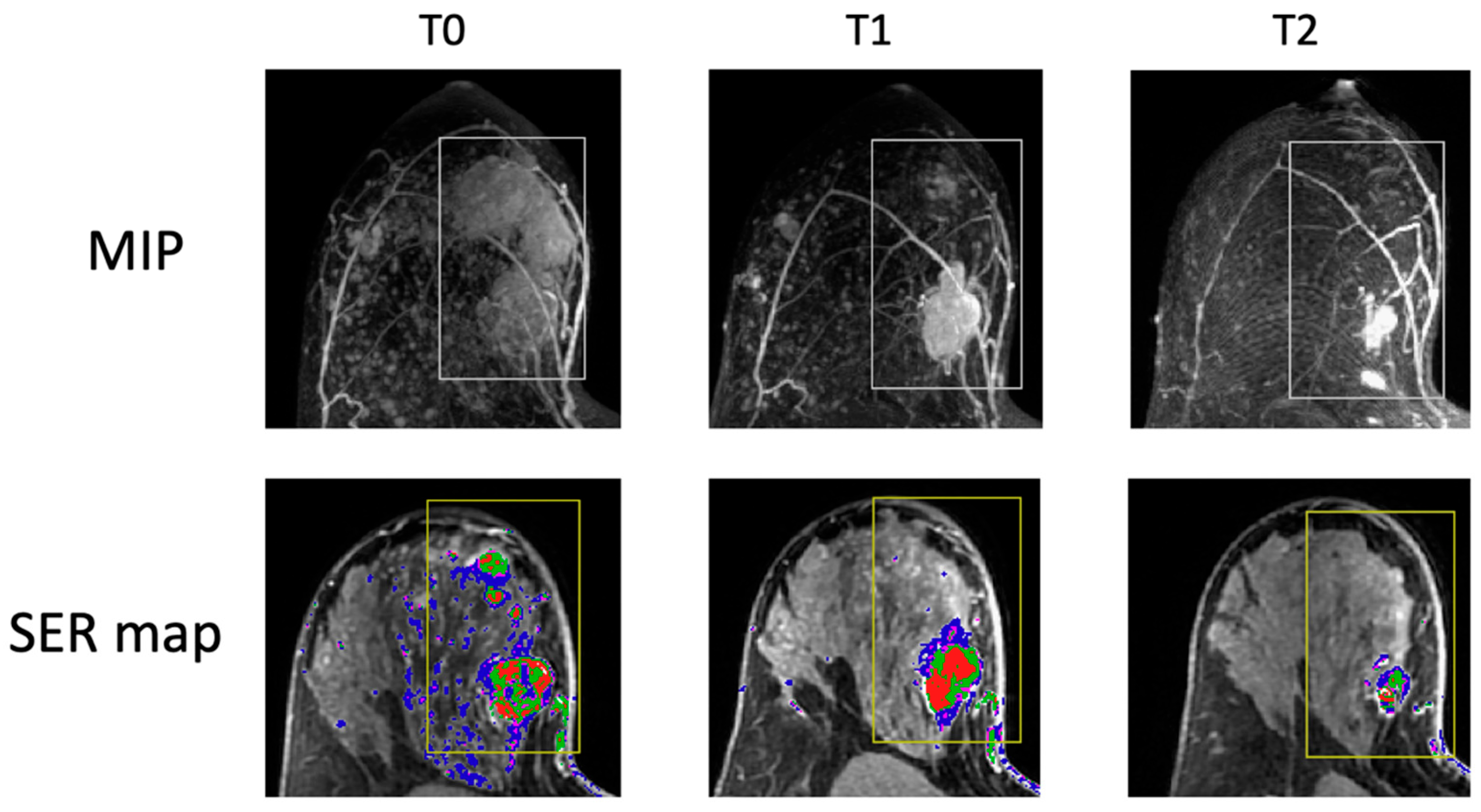 Tomography 11 00026 g004