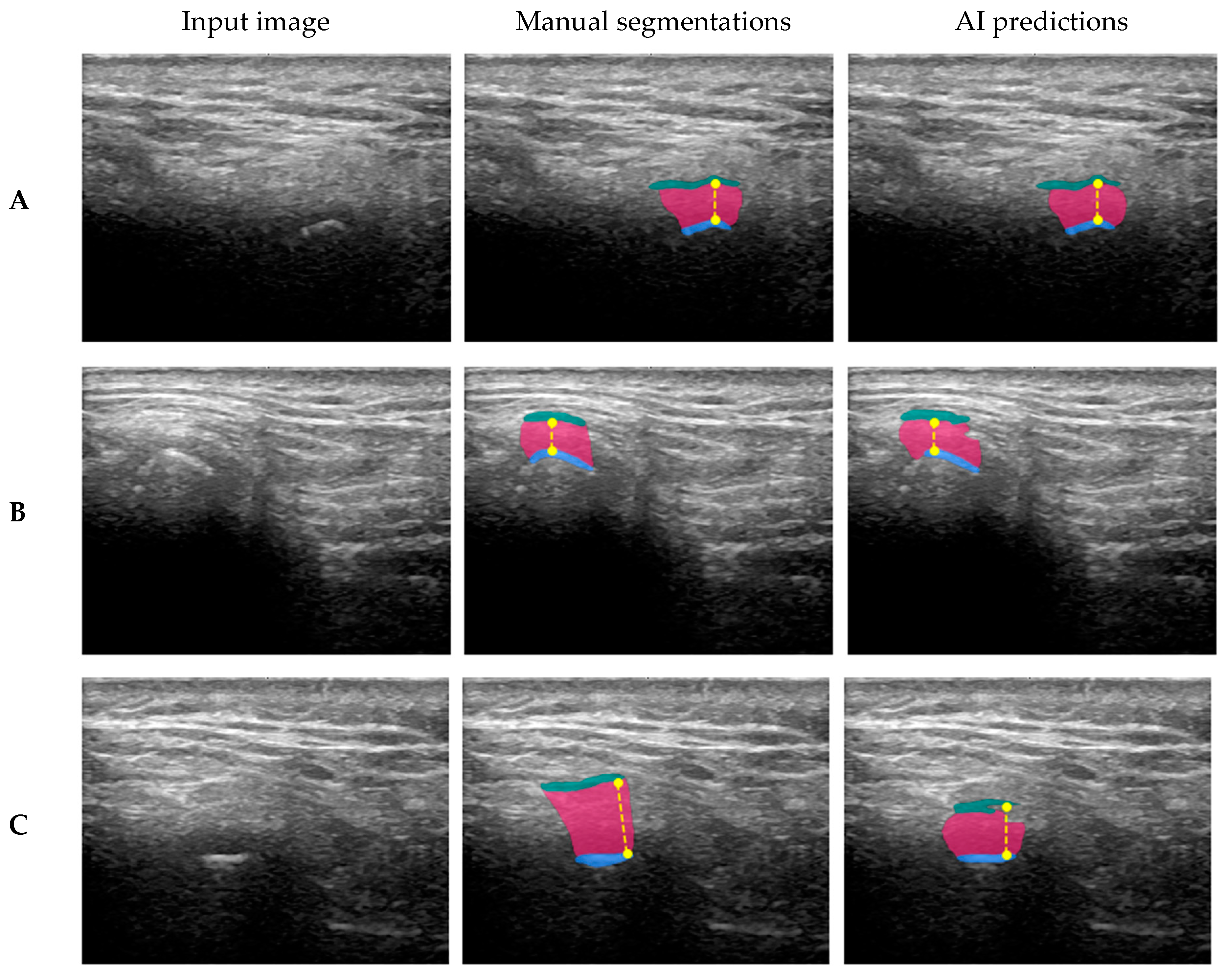 Tomography 11 00027 g006