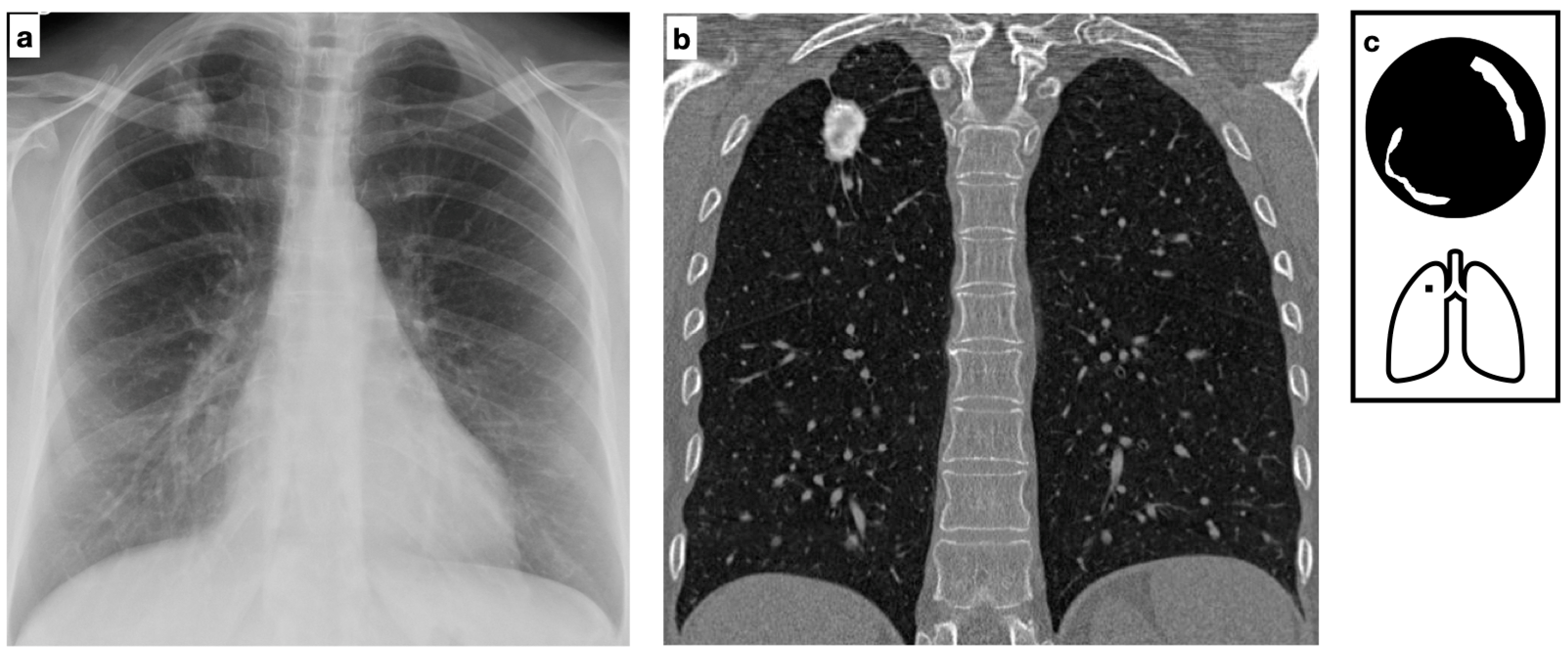 Tomography 11 00028 g004