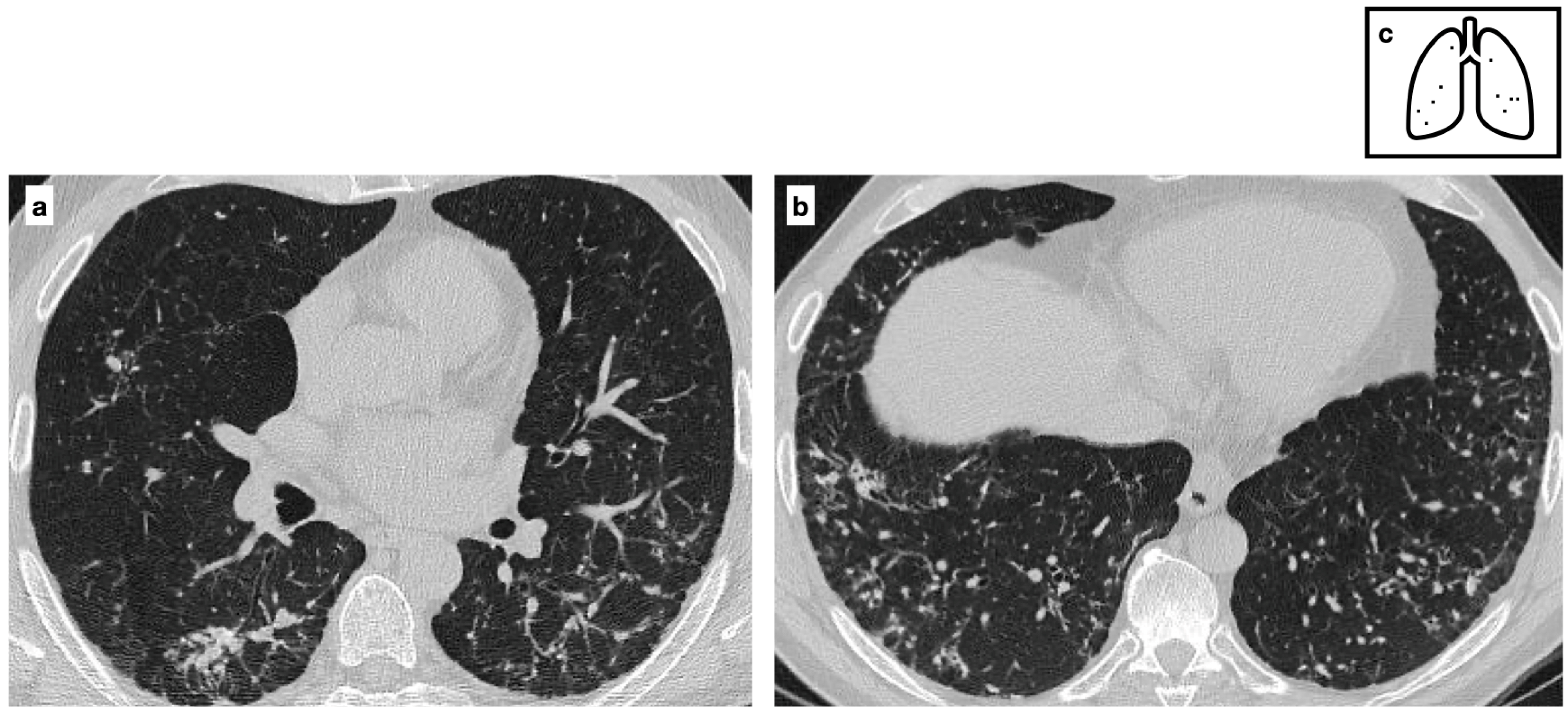 Tomography 11 00028 g005