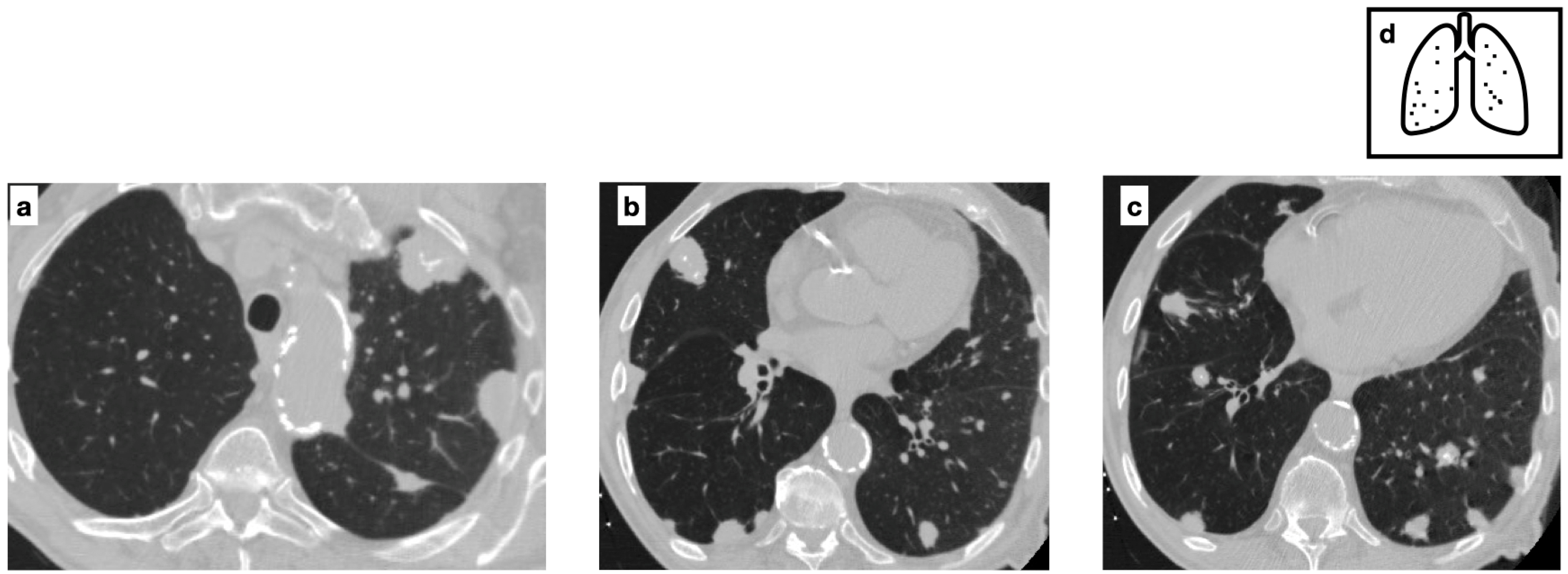 Tomography 11 00028 g007