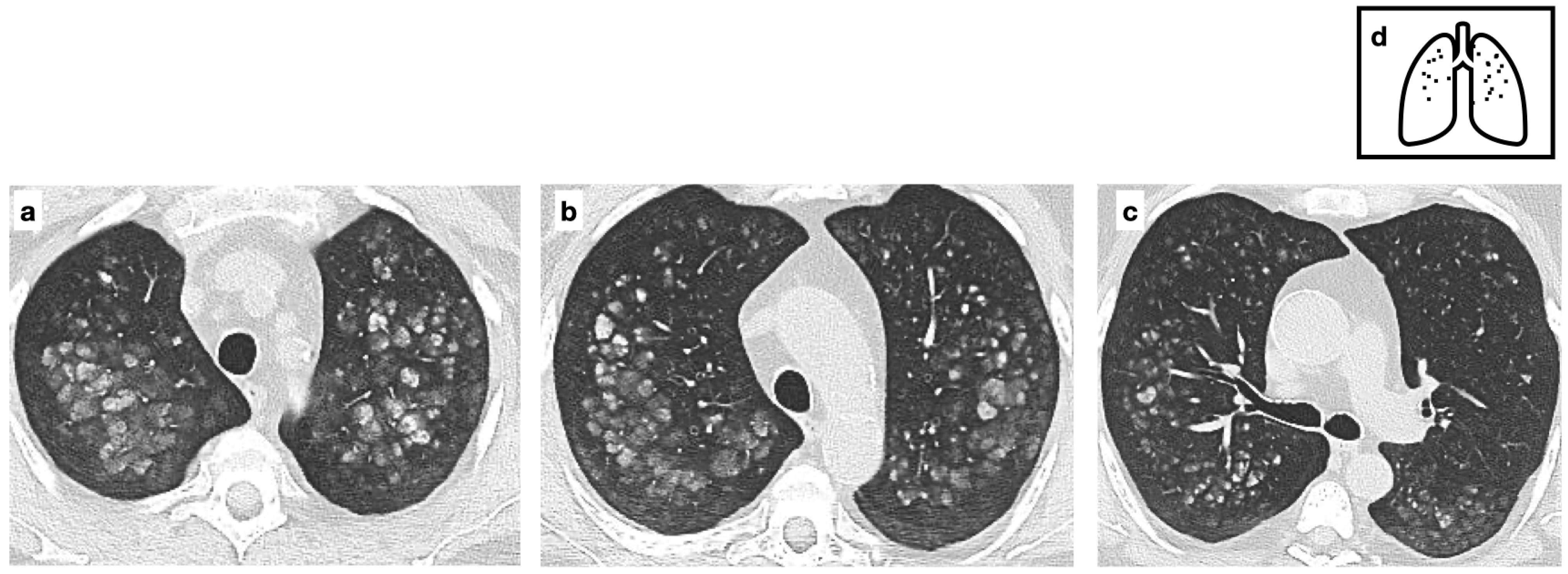 Tomography 11 00028 g008