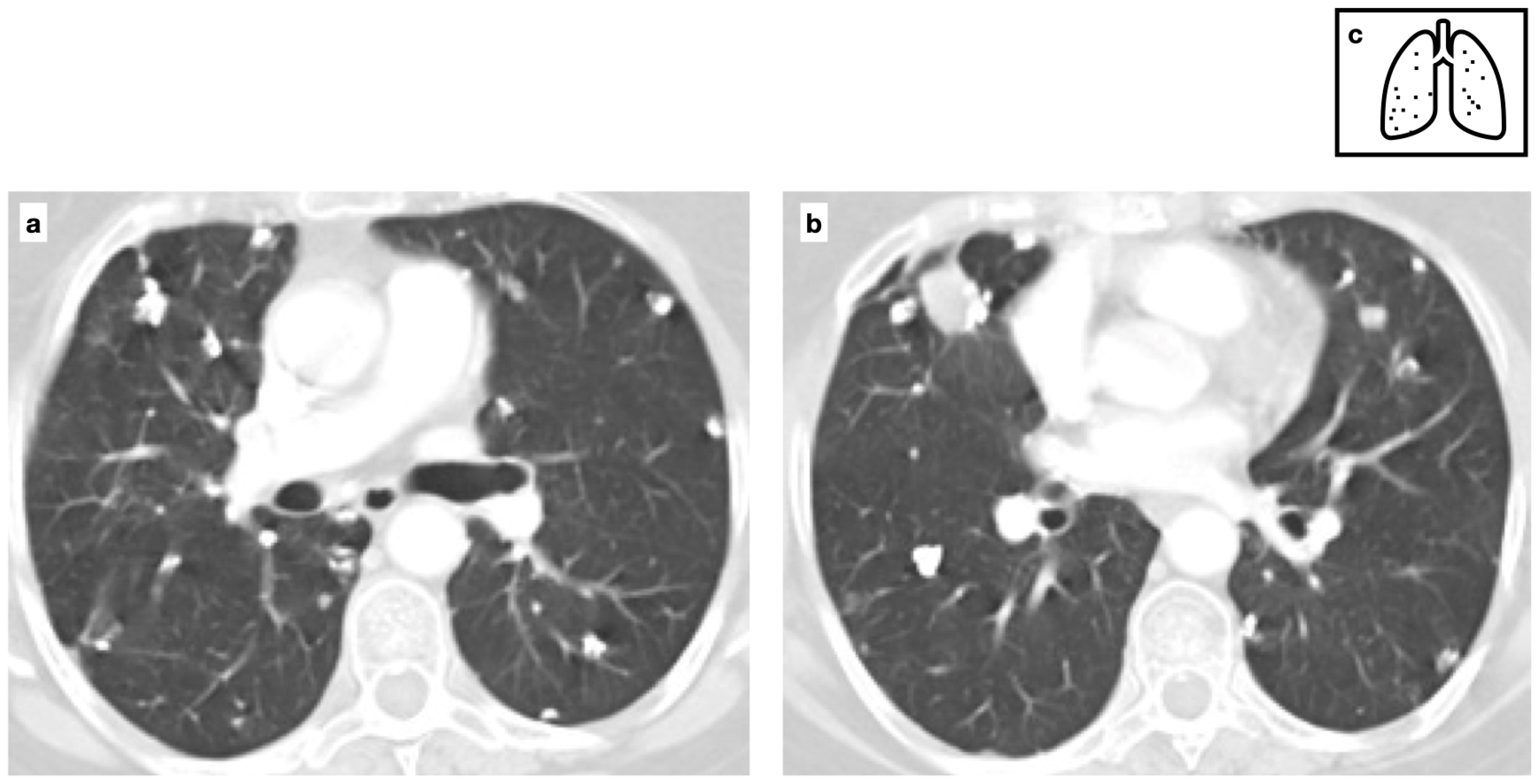 Tomography 11 00028 g010