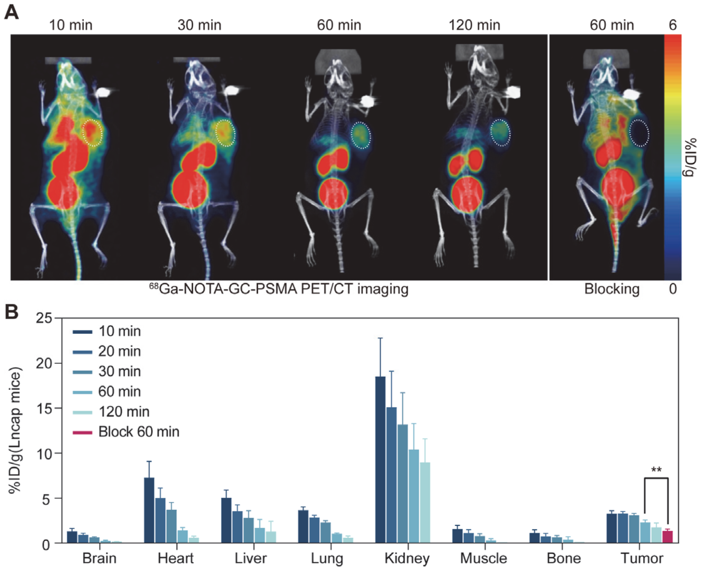 Tomography 11 00029 g005