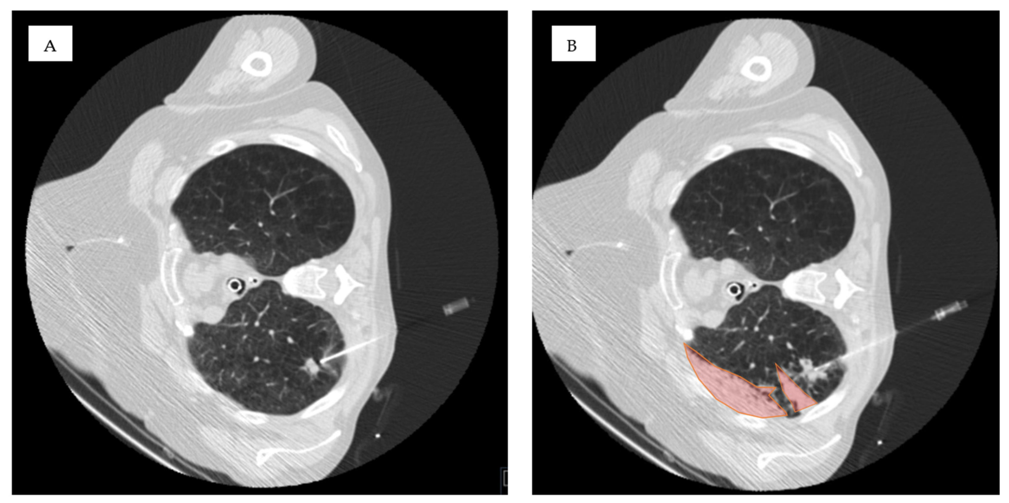 Tomography 11 00035 g002