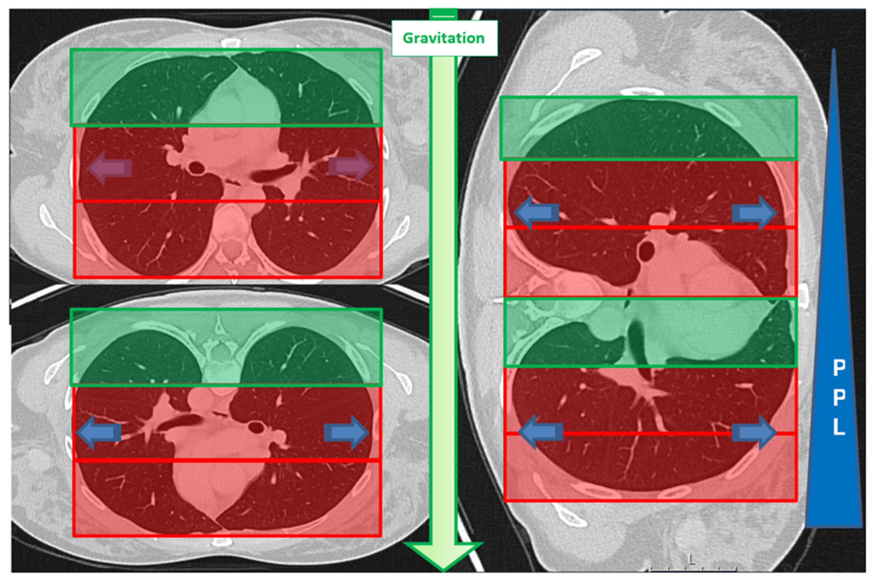 Tomography 11 00035 g003