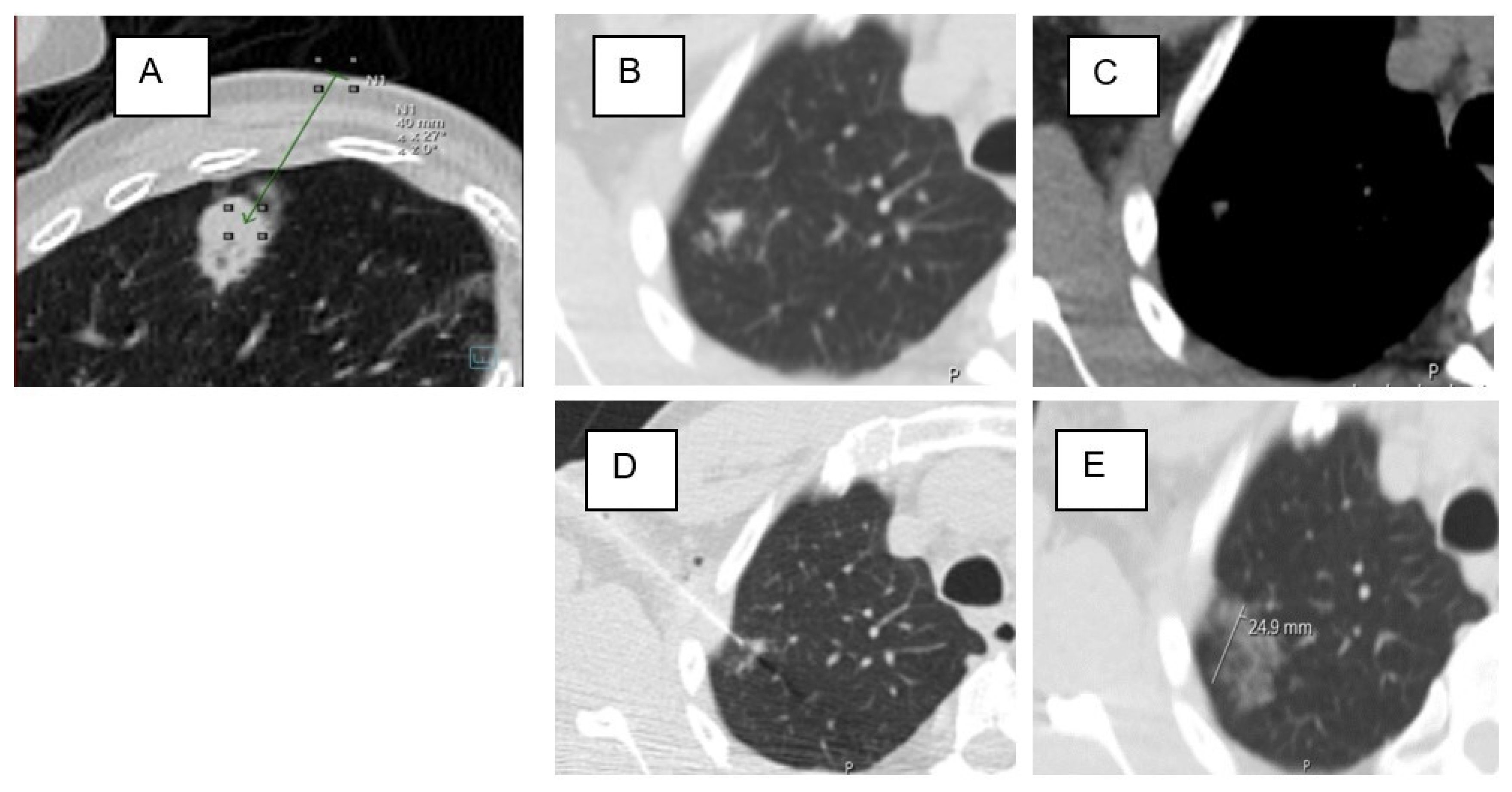 Tomography 11 00035 g004