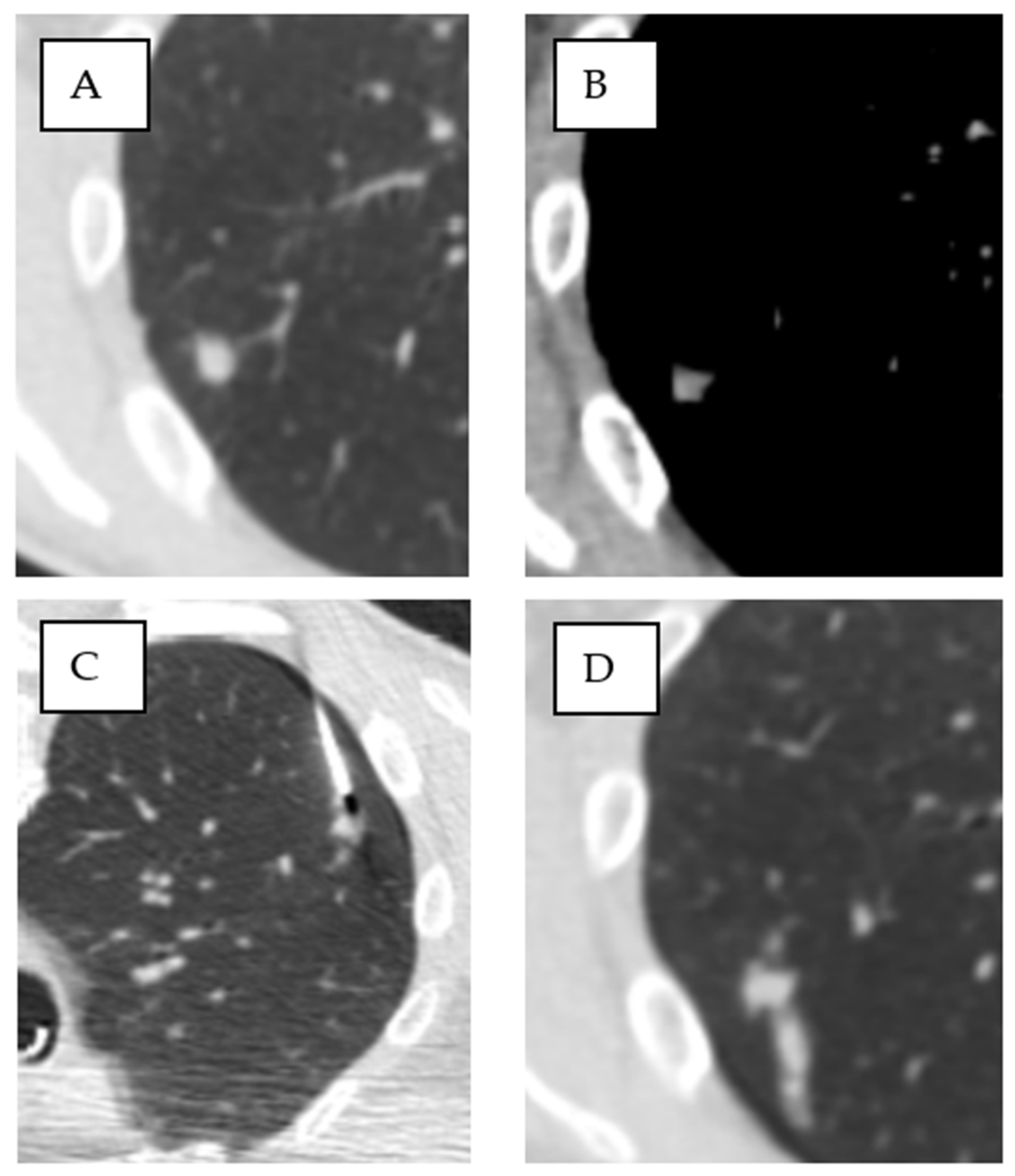 Tomography 11 00035 g005