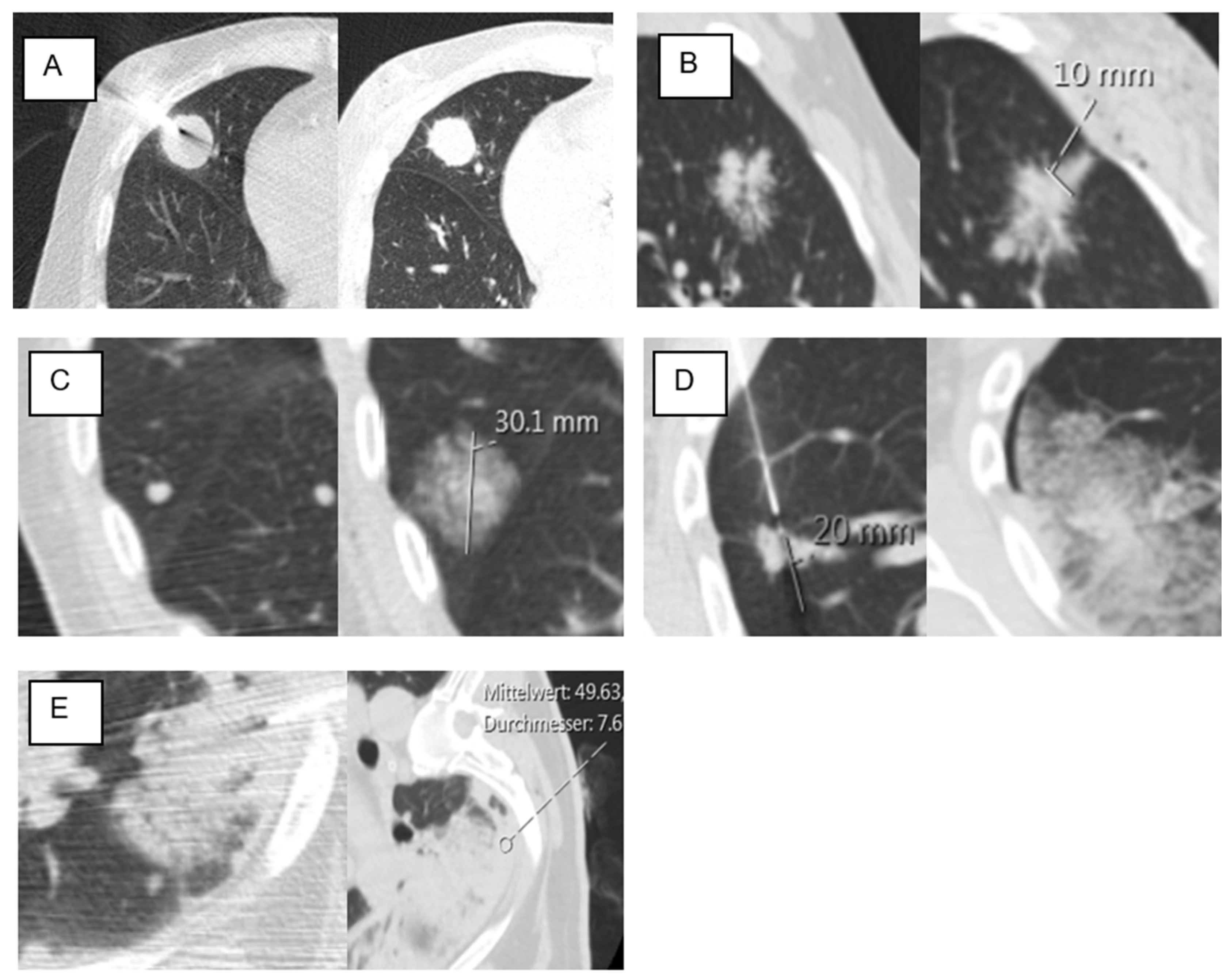 Tomography 11 00035 g006