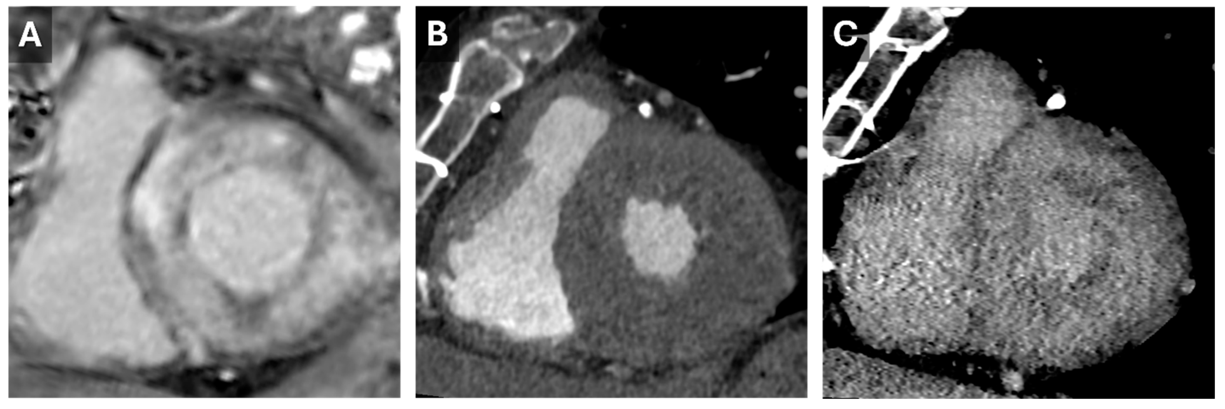 Tomography 11 00039 g005