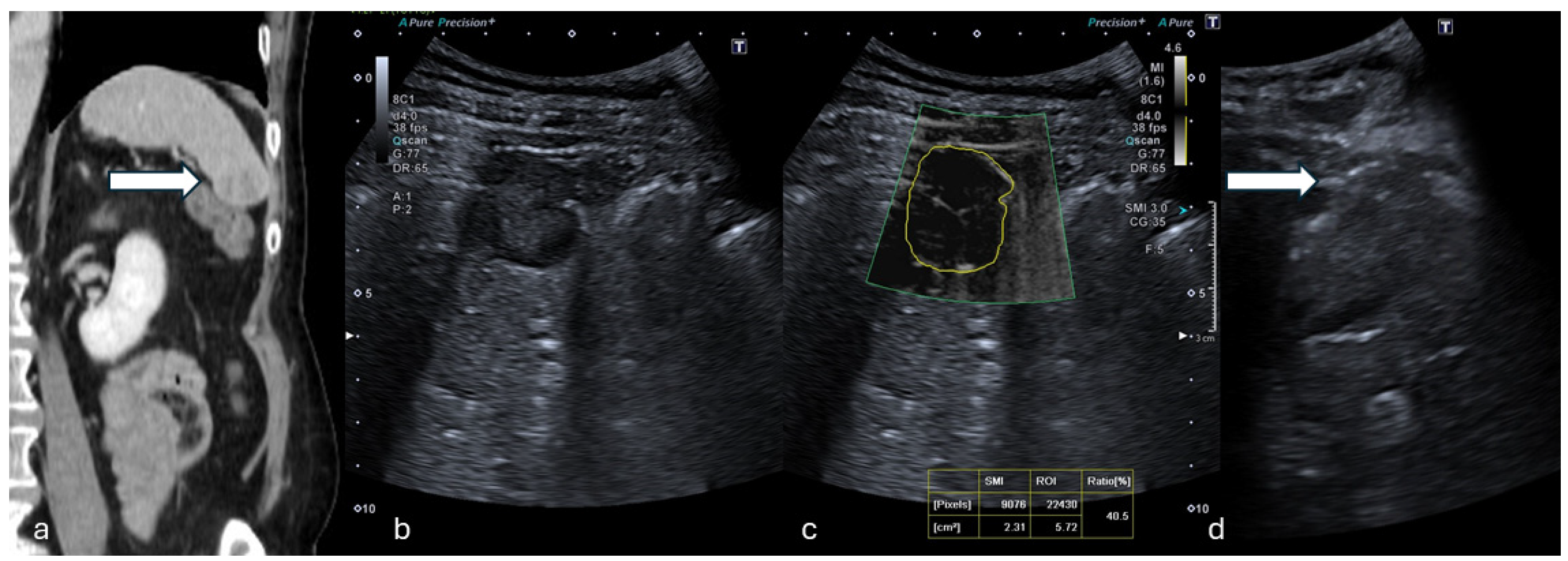 Tomography 11 00043 g001