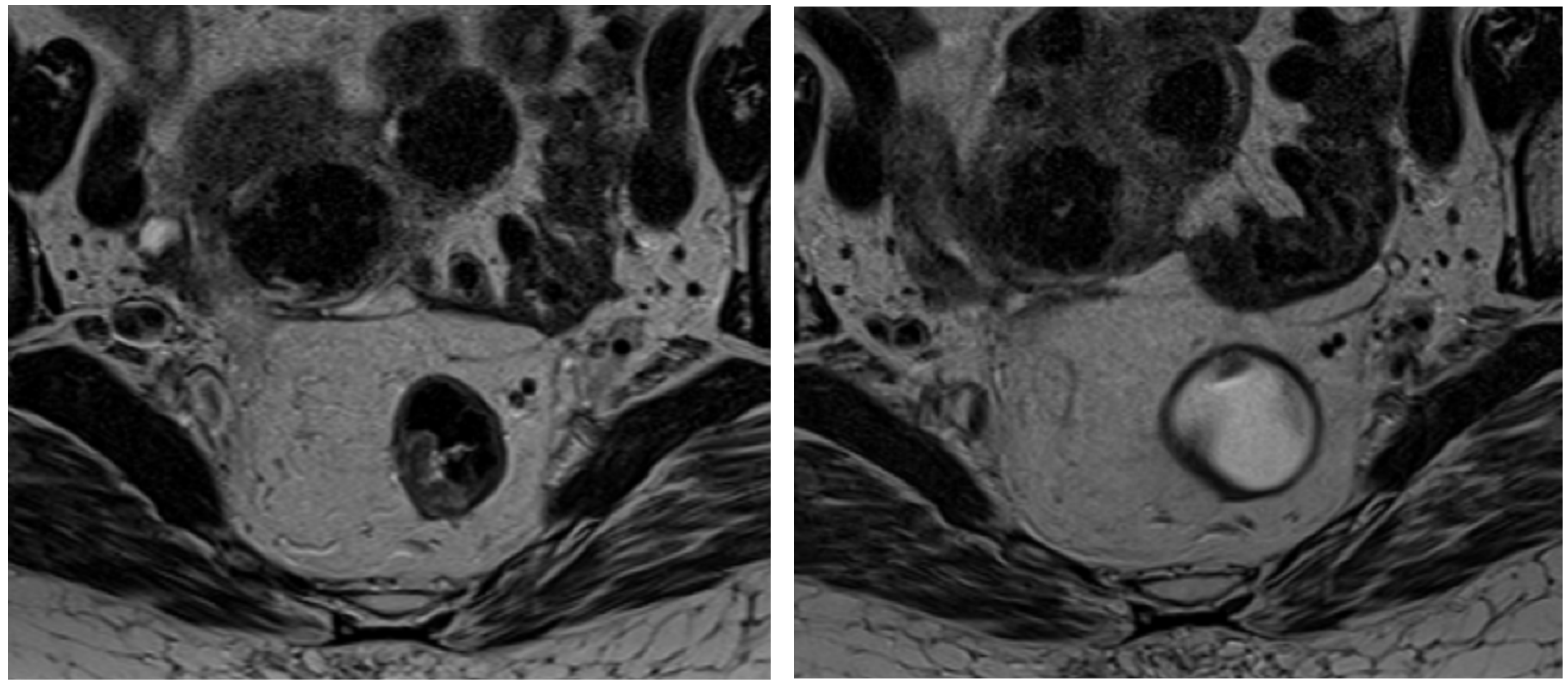 Tomography 11 00044 g001 Tomography 11 00044 g001