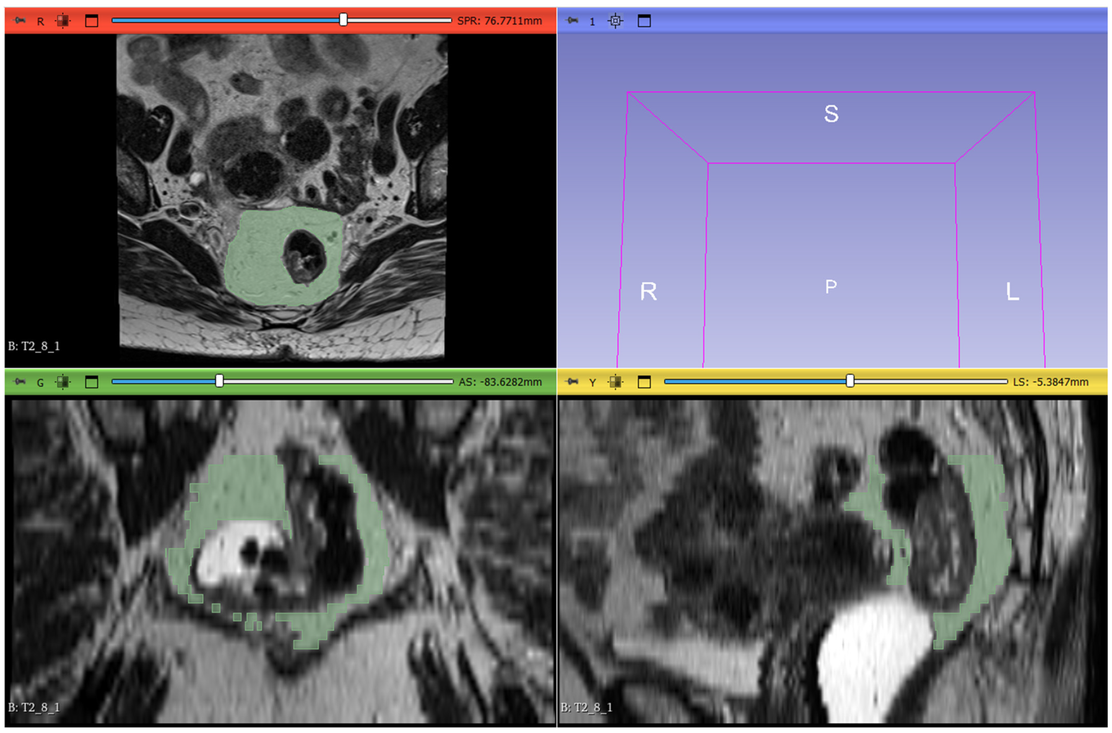 Tomography 11 00044 g002 Tomography 11 00044 g002