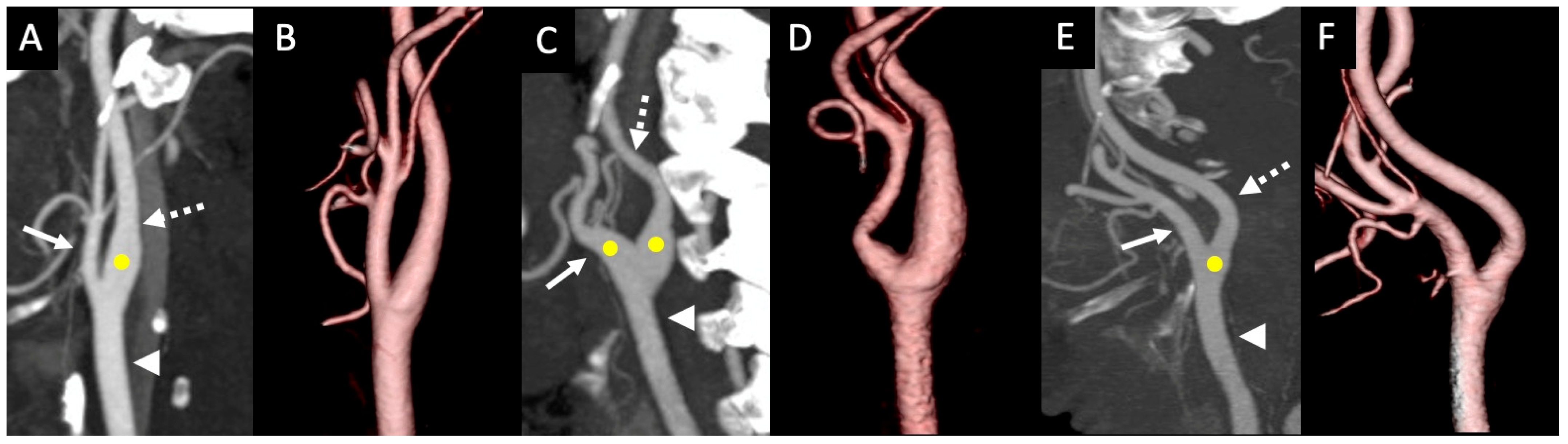 Tomography 11 00045 g001