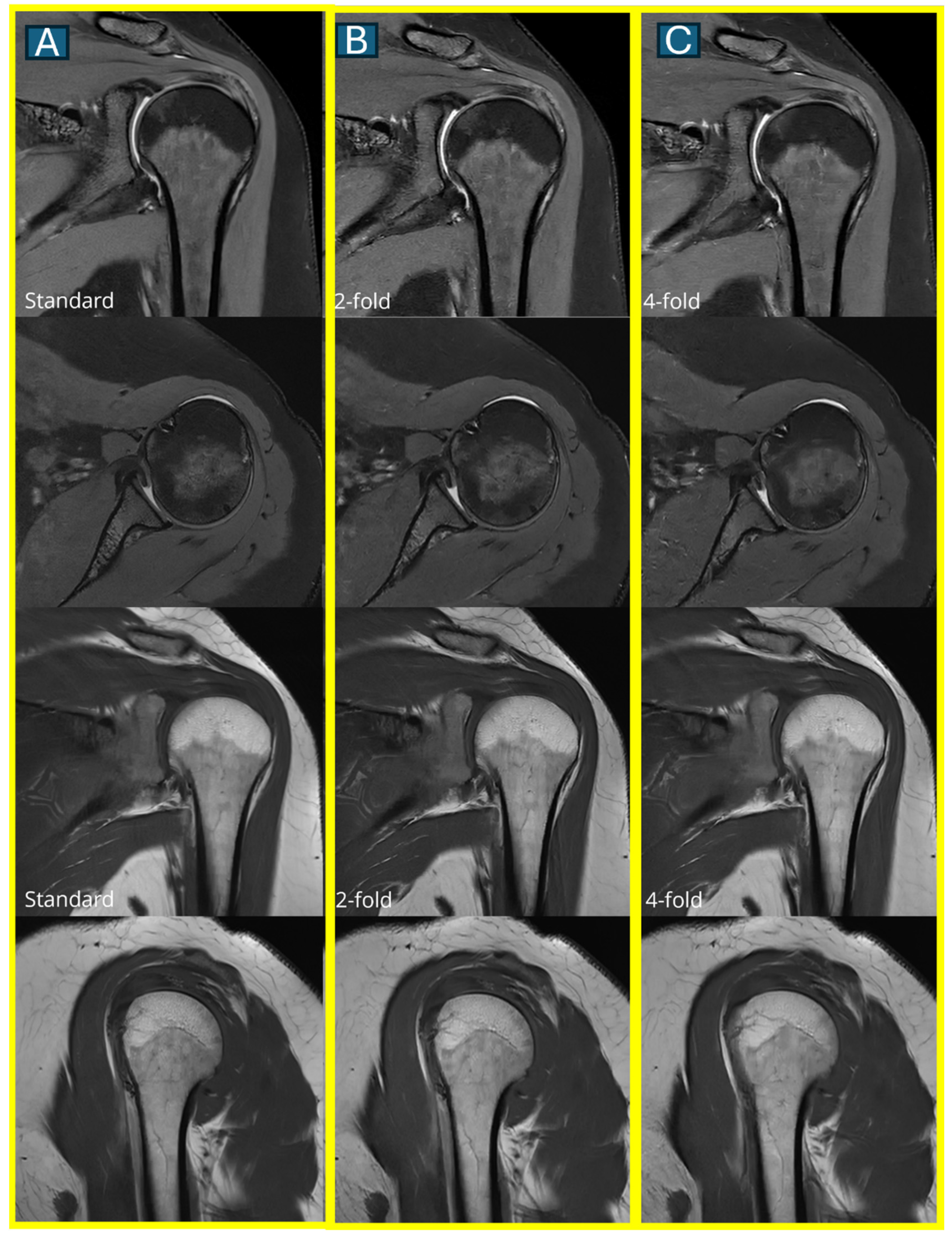 Tomography 11 00048 g004 Tomography 11 00048 g004
