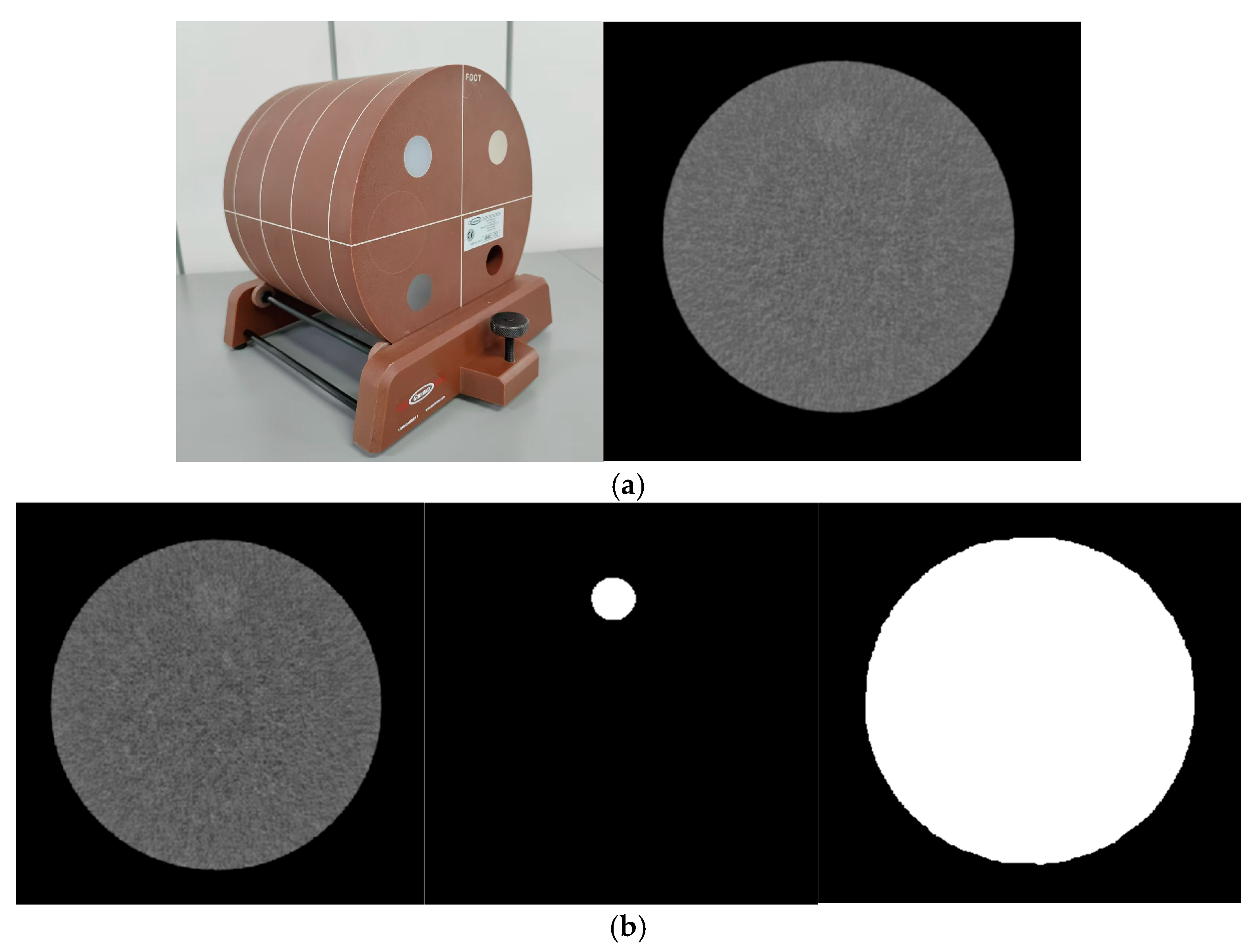 Tomography 11 00051 g001