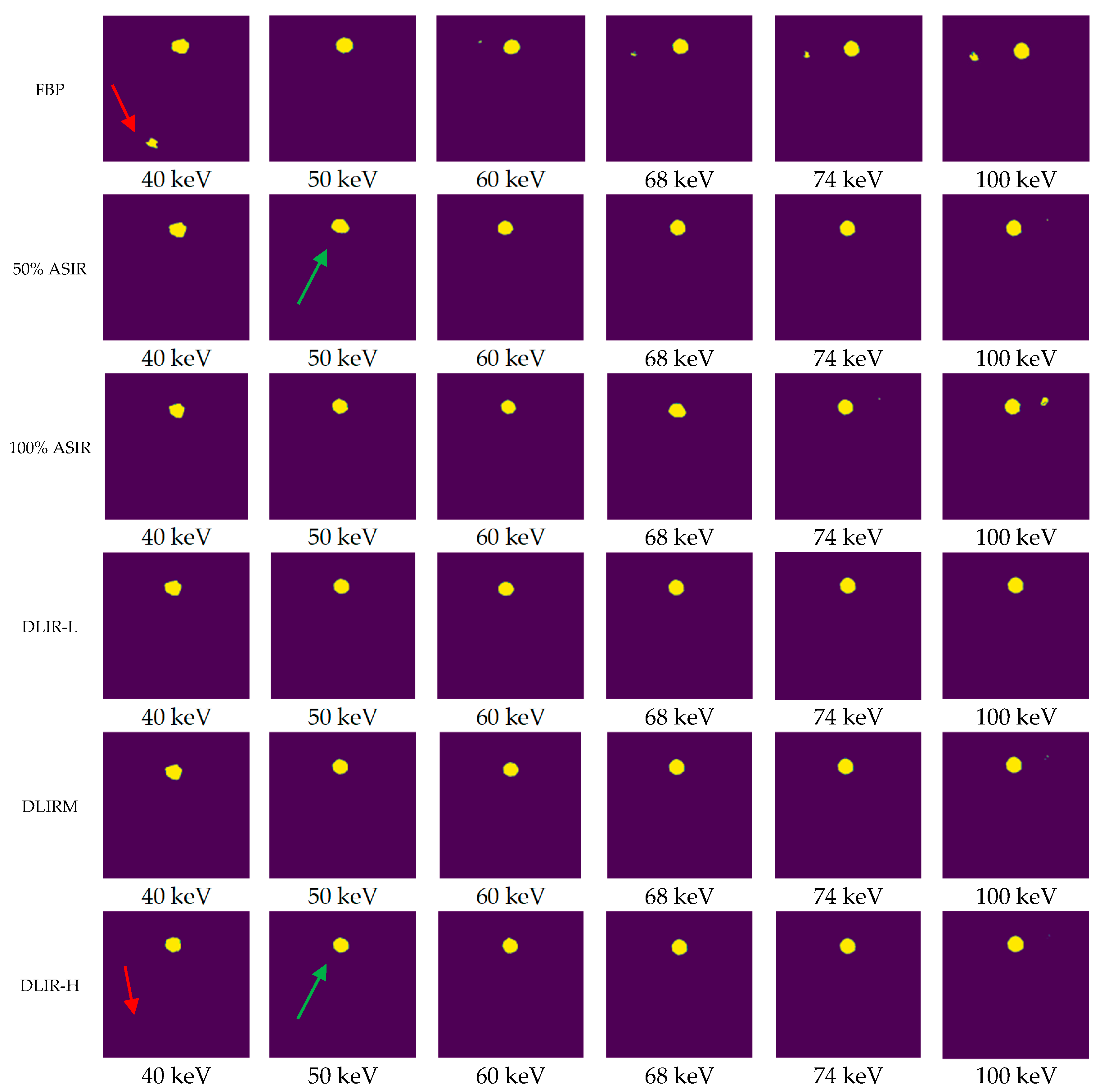 Tomography 11 00051 g004