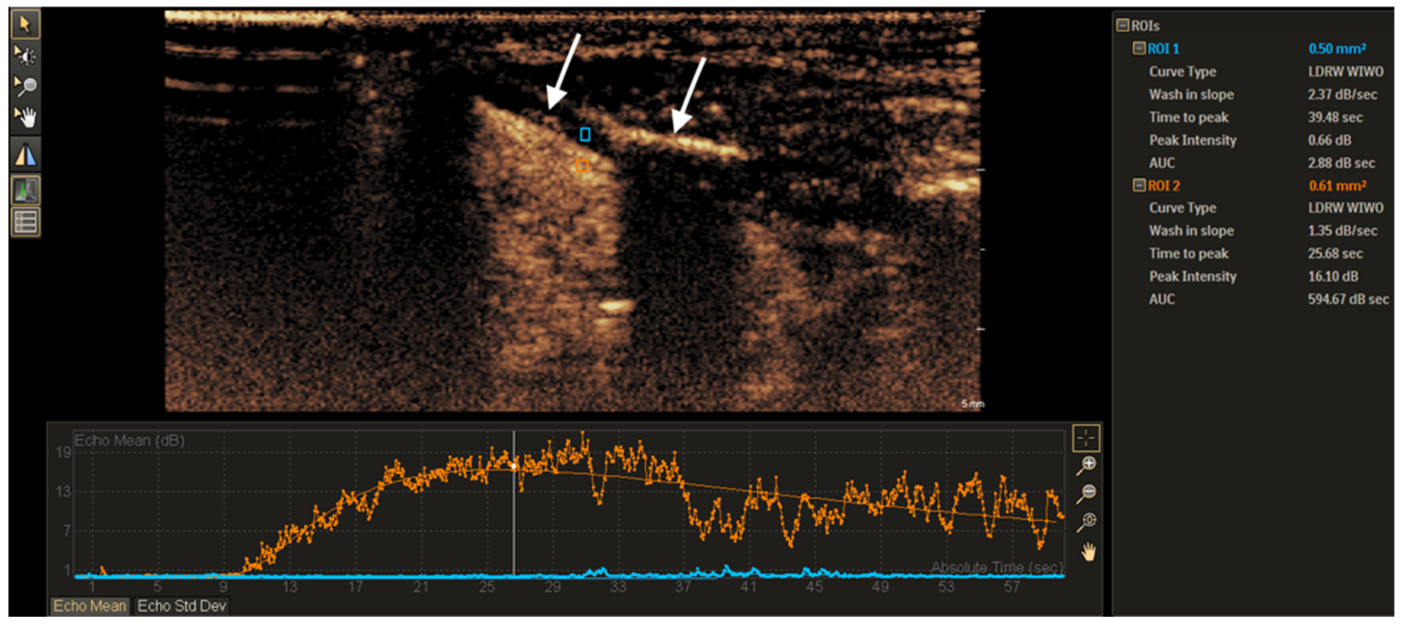 Tomography 11 00057 g001 Tomography 11 00057 g001