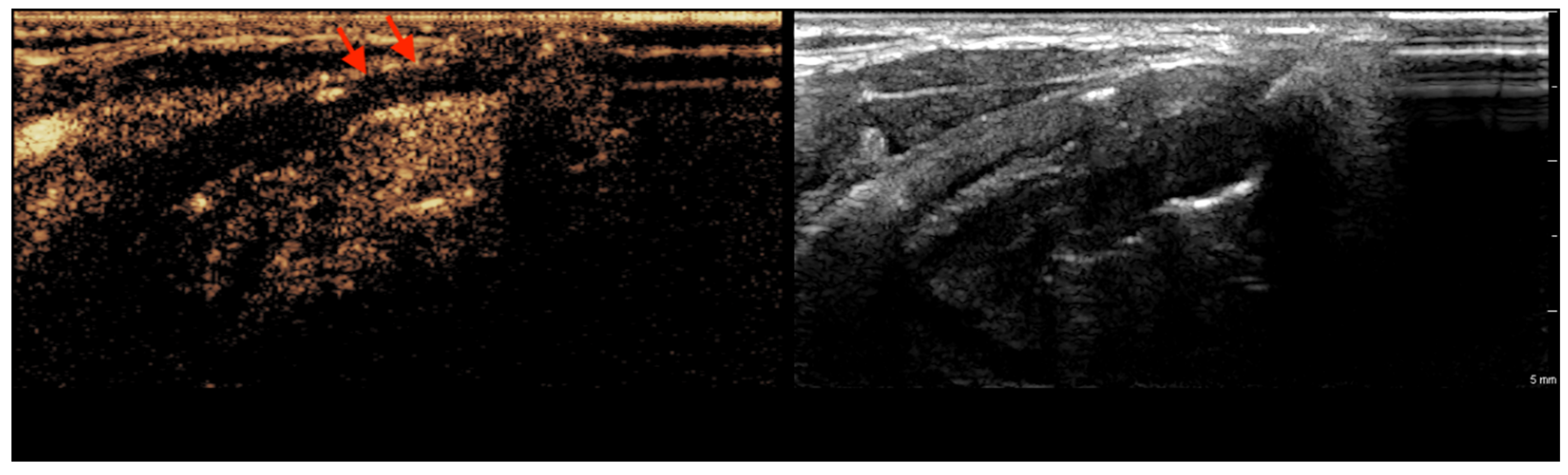 Tomography 11 00057 g002 Tomography 11 00057 g002
