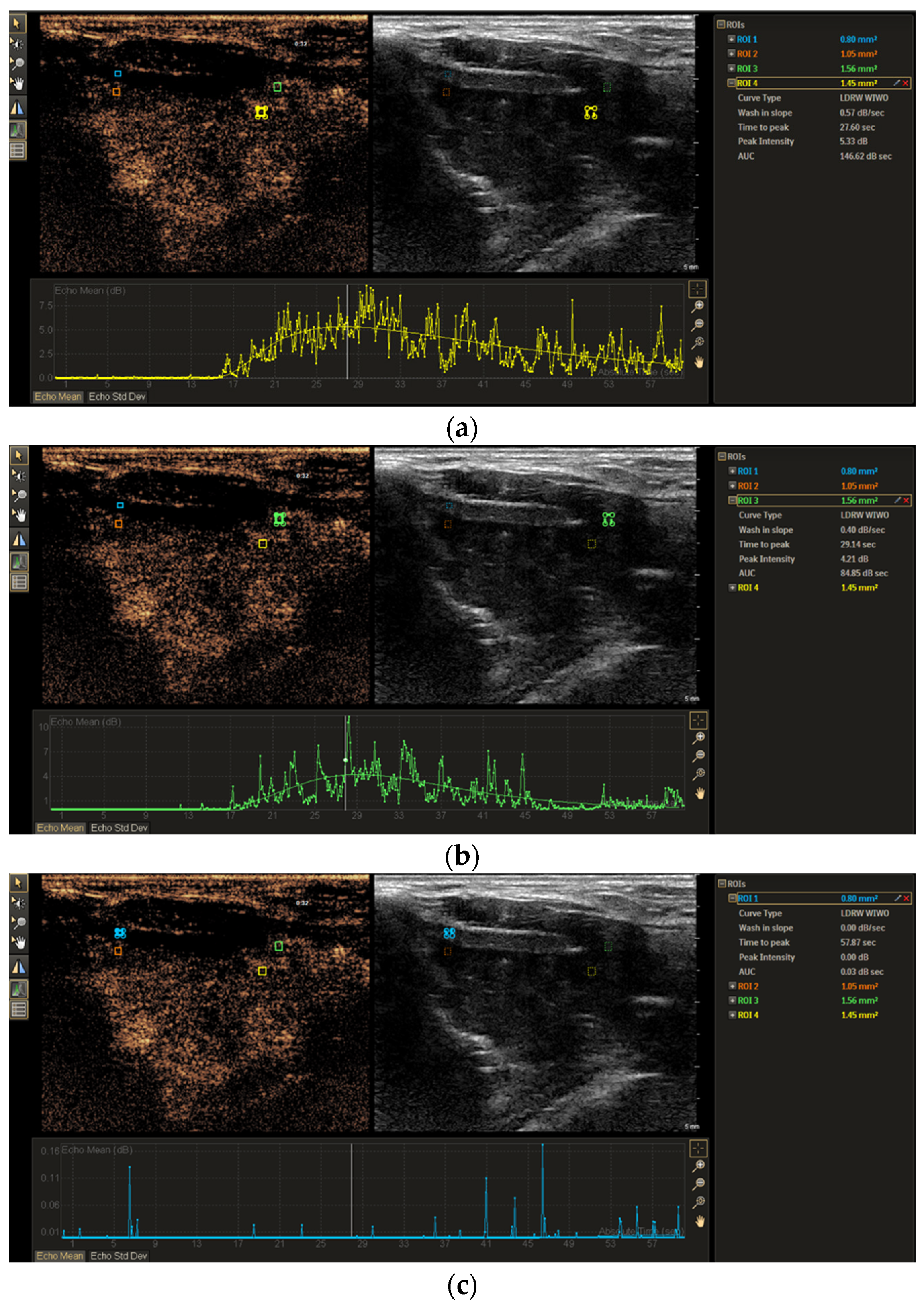 Tomography 11 00057 g003 Tomography 11 00057 g003