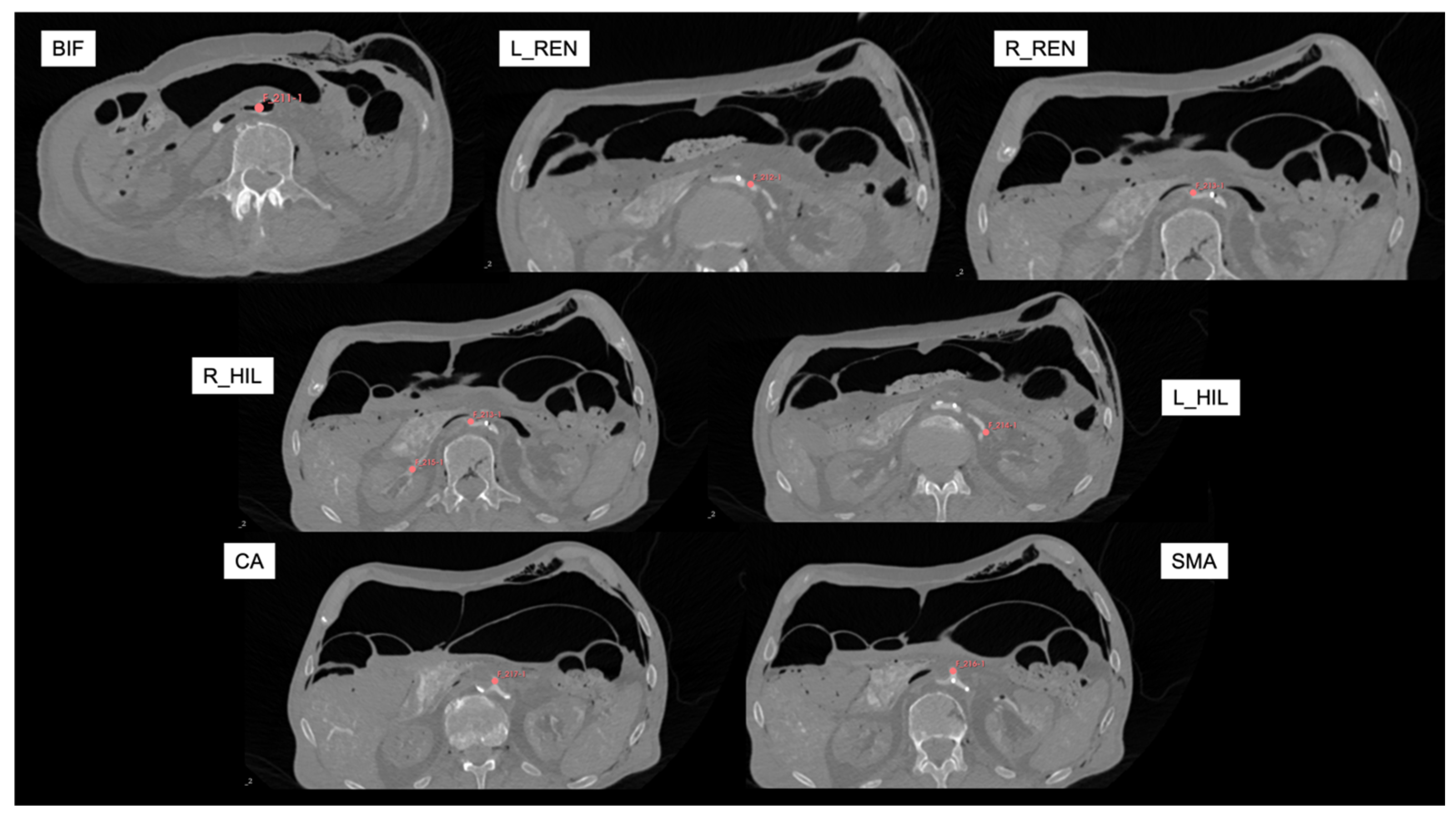 Tomography 11 00060 g002 Tomography 11 00060 g002