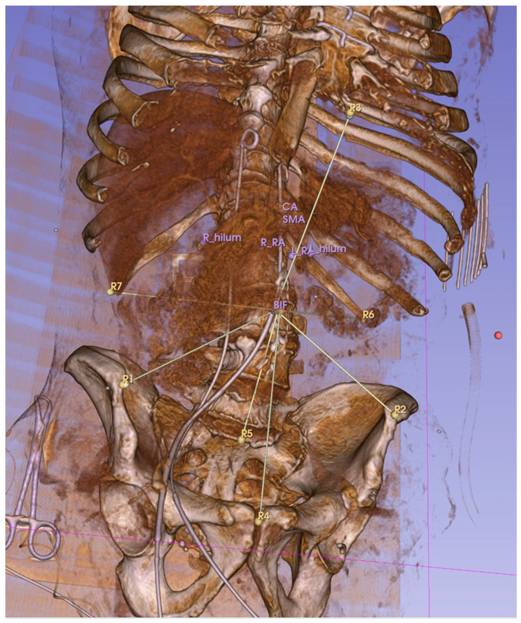 Tomography 11 00060 g003 Tomography 11 00060 g003