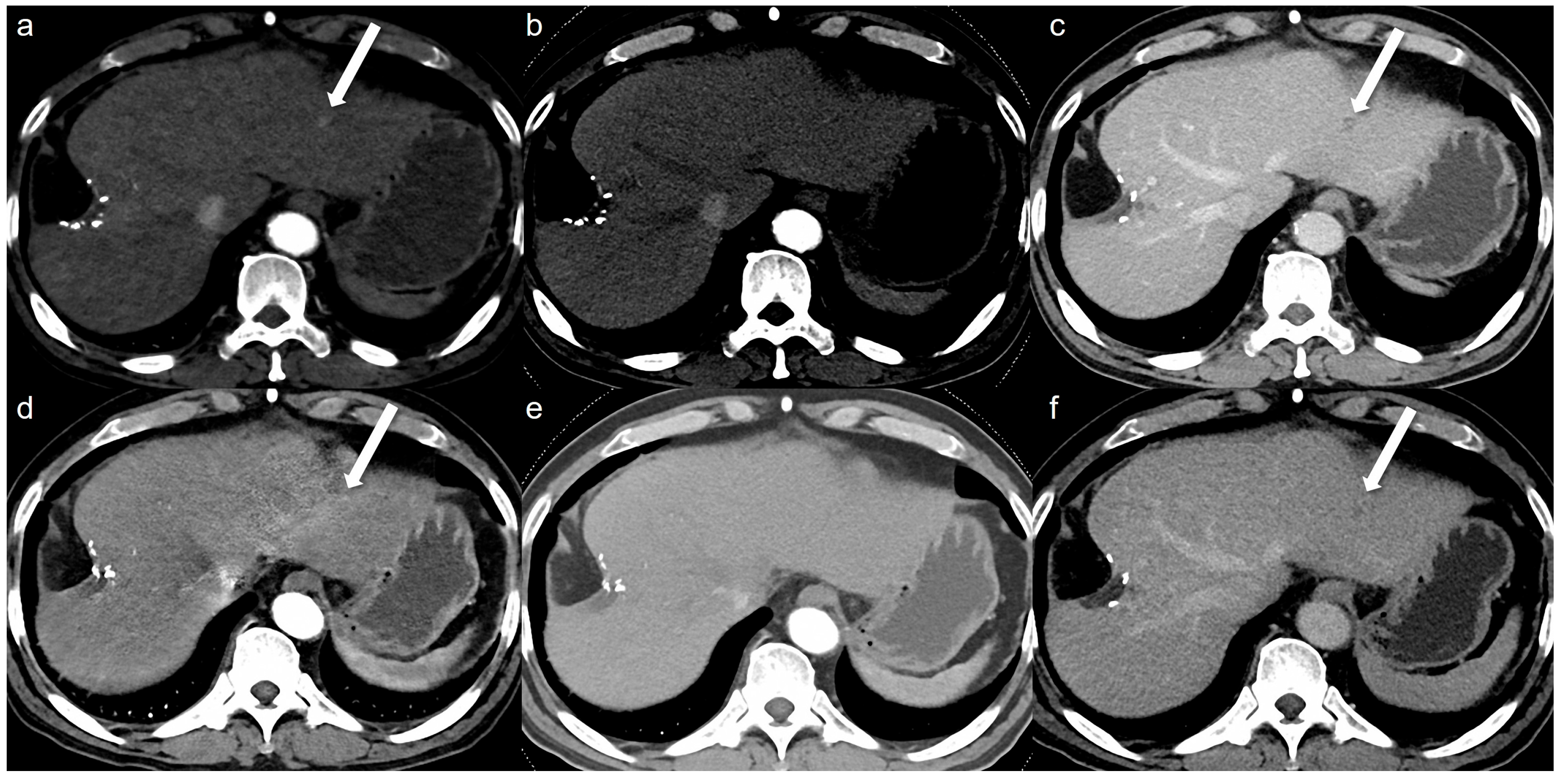 Tomography 11 00066 g002