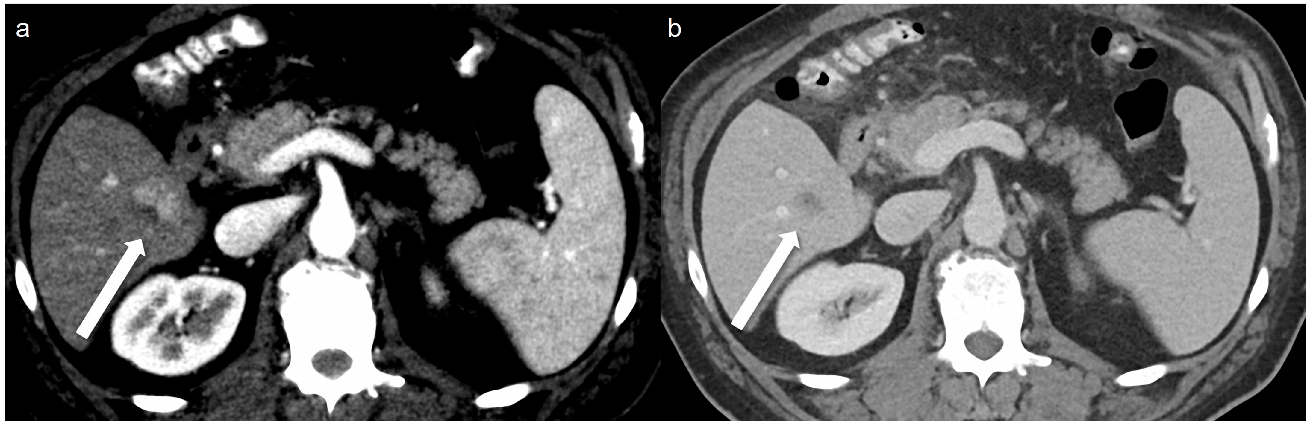 Tomography 11 00066 g004