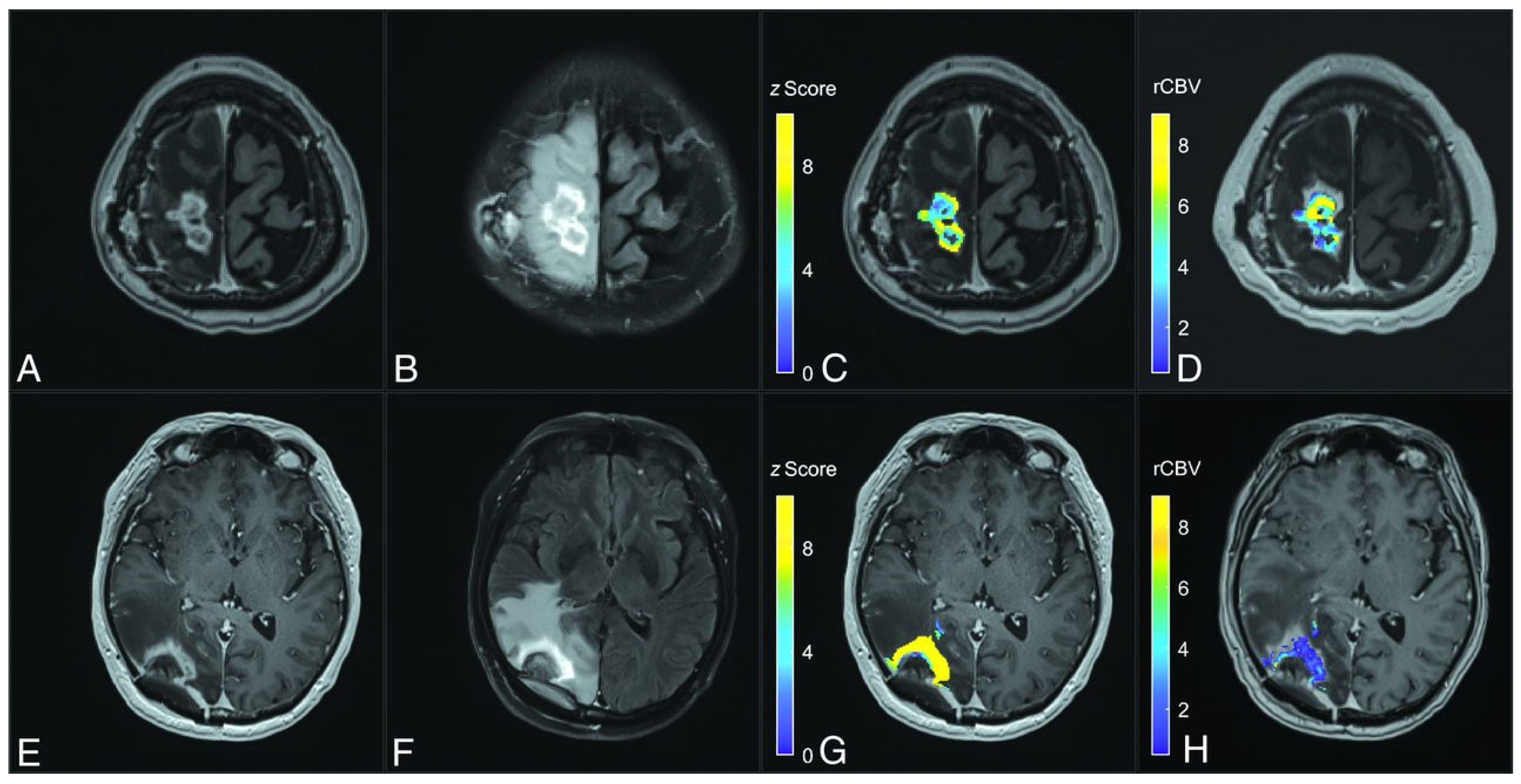 Tomography 11 00068 g004