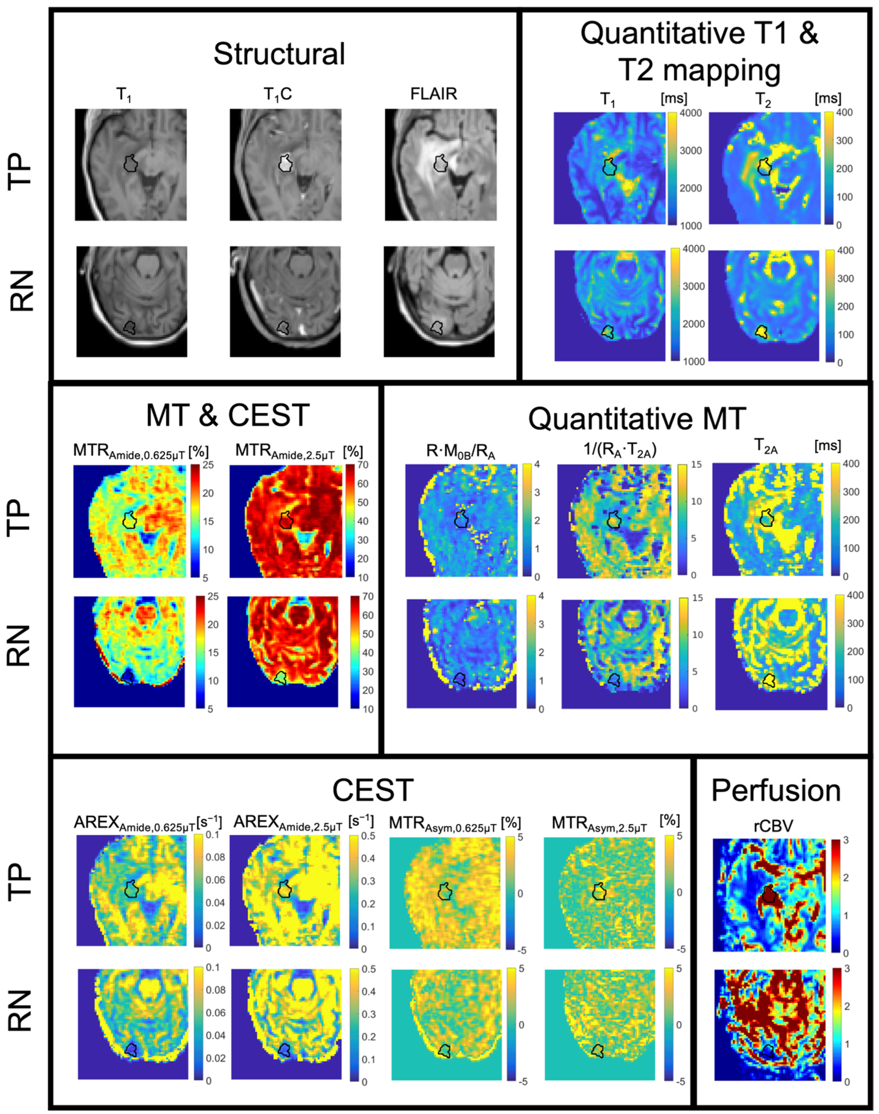 Tomography 11 00068 g006