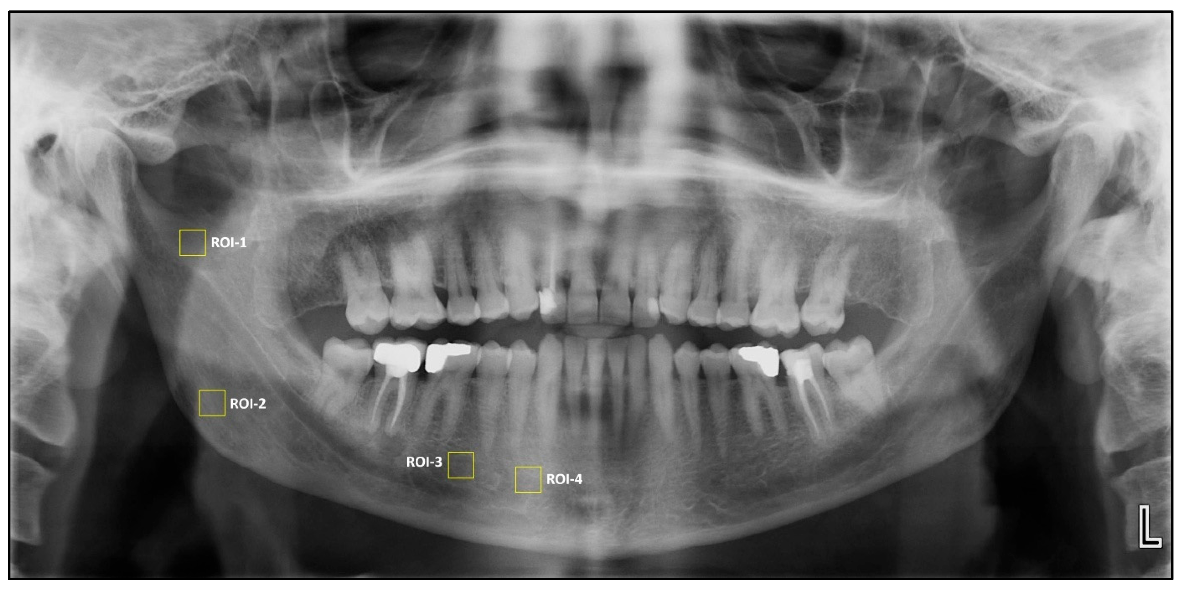 Tomography 11 00070 g001
