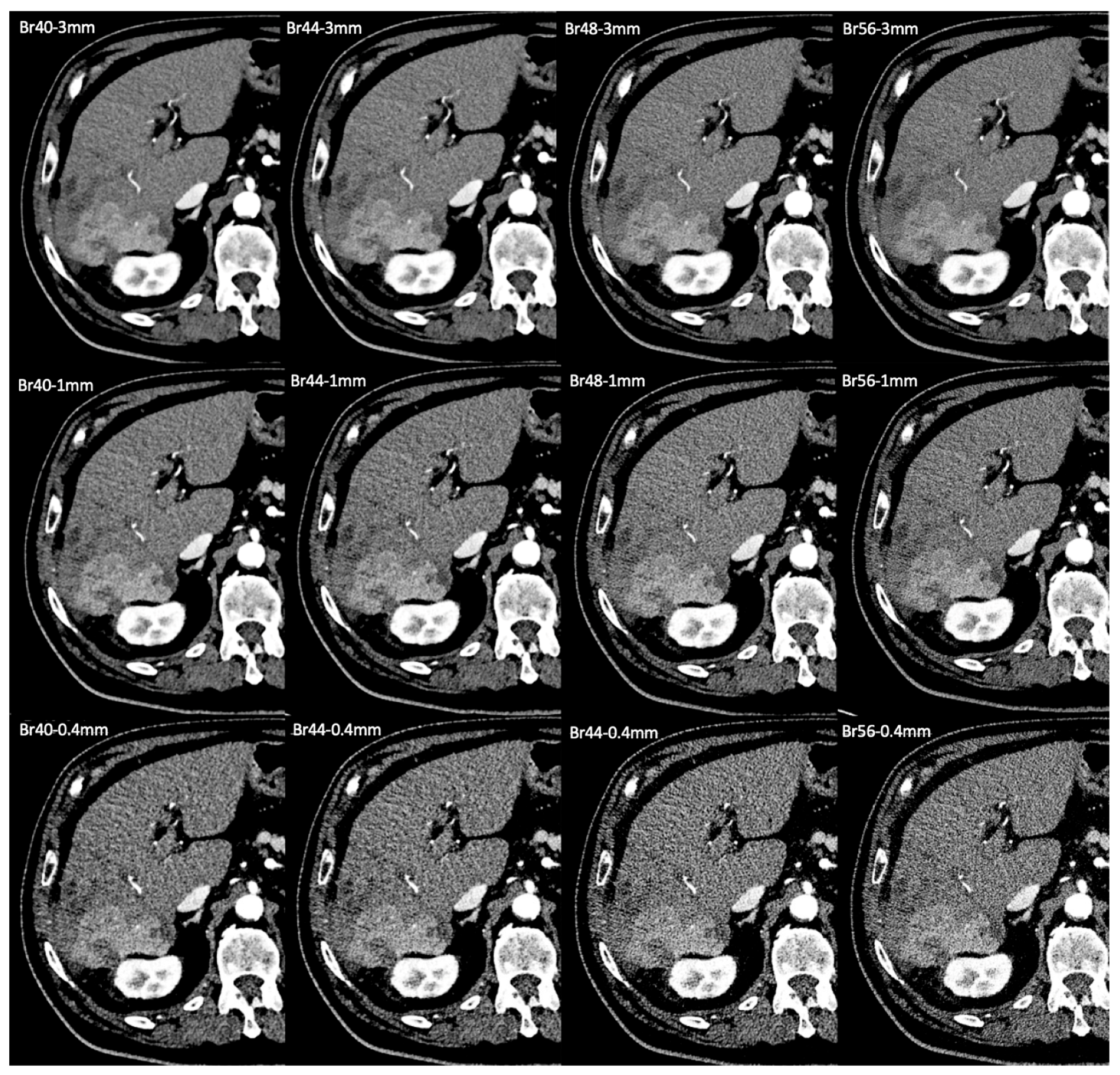 Tomography 11 00077 g005 Tomography 11 00077 g005