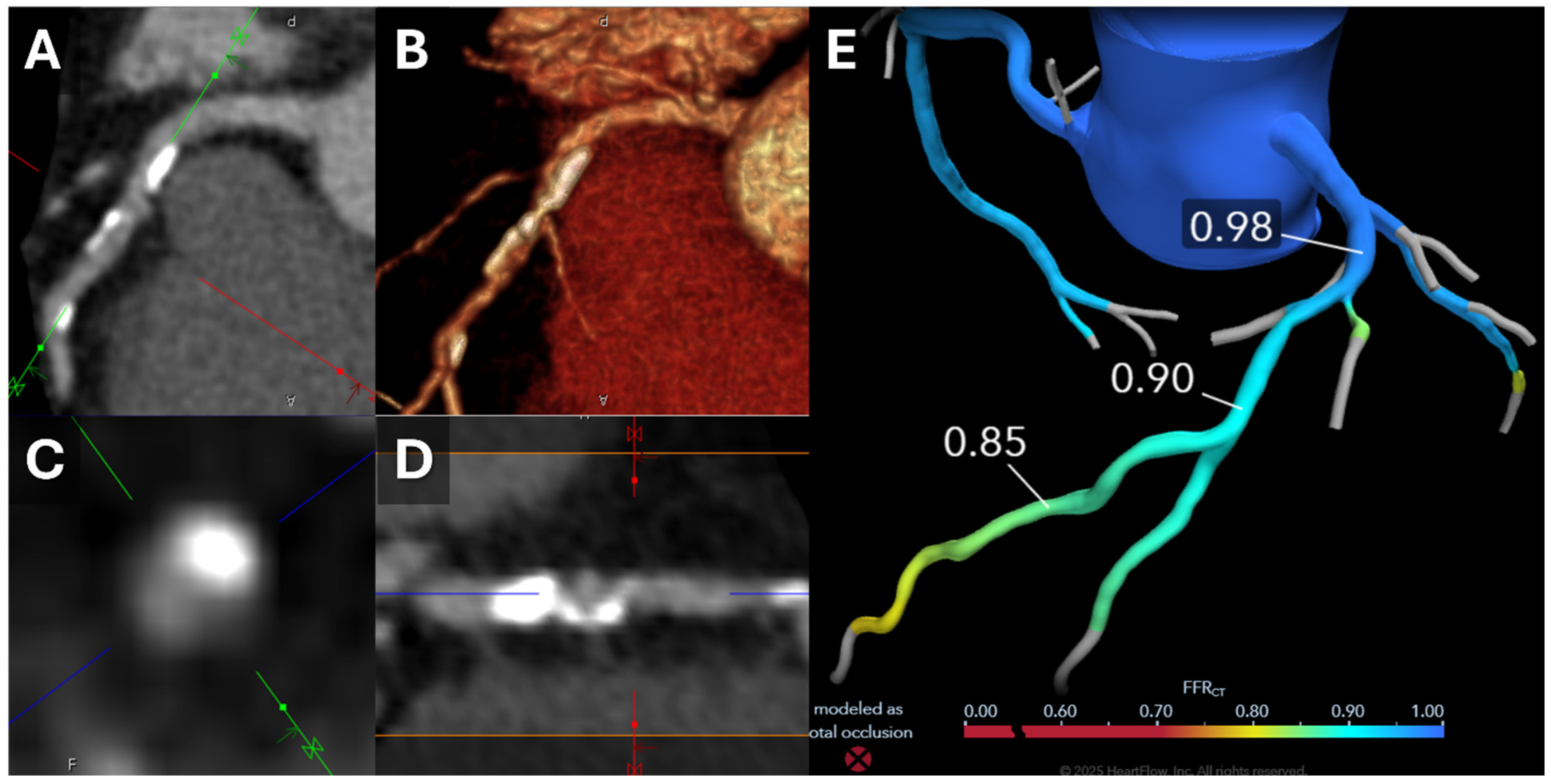 Tomography 11 00085 g001