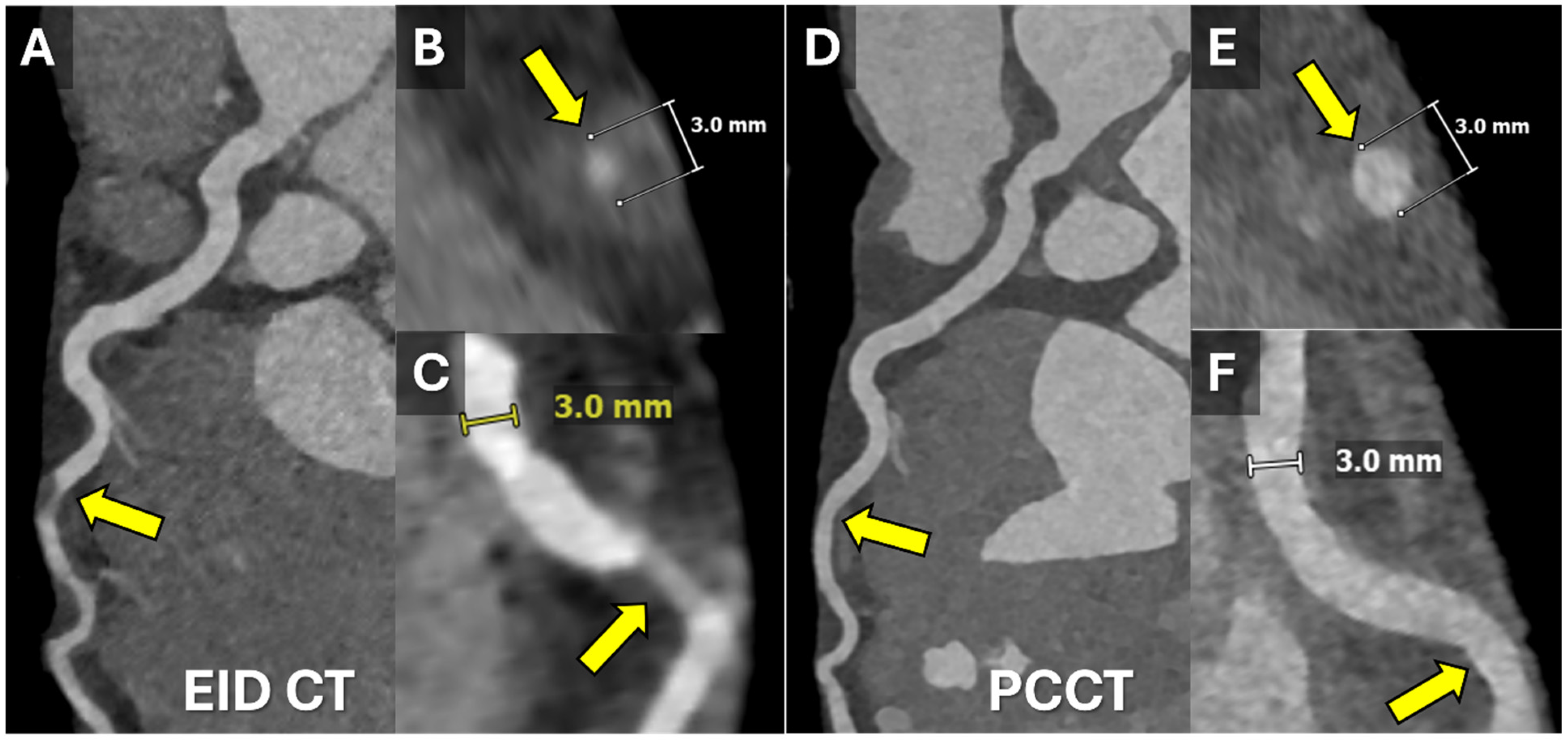Tomography 11 00085 g002