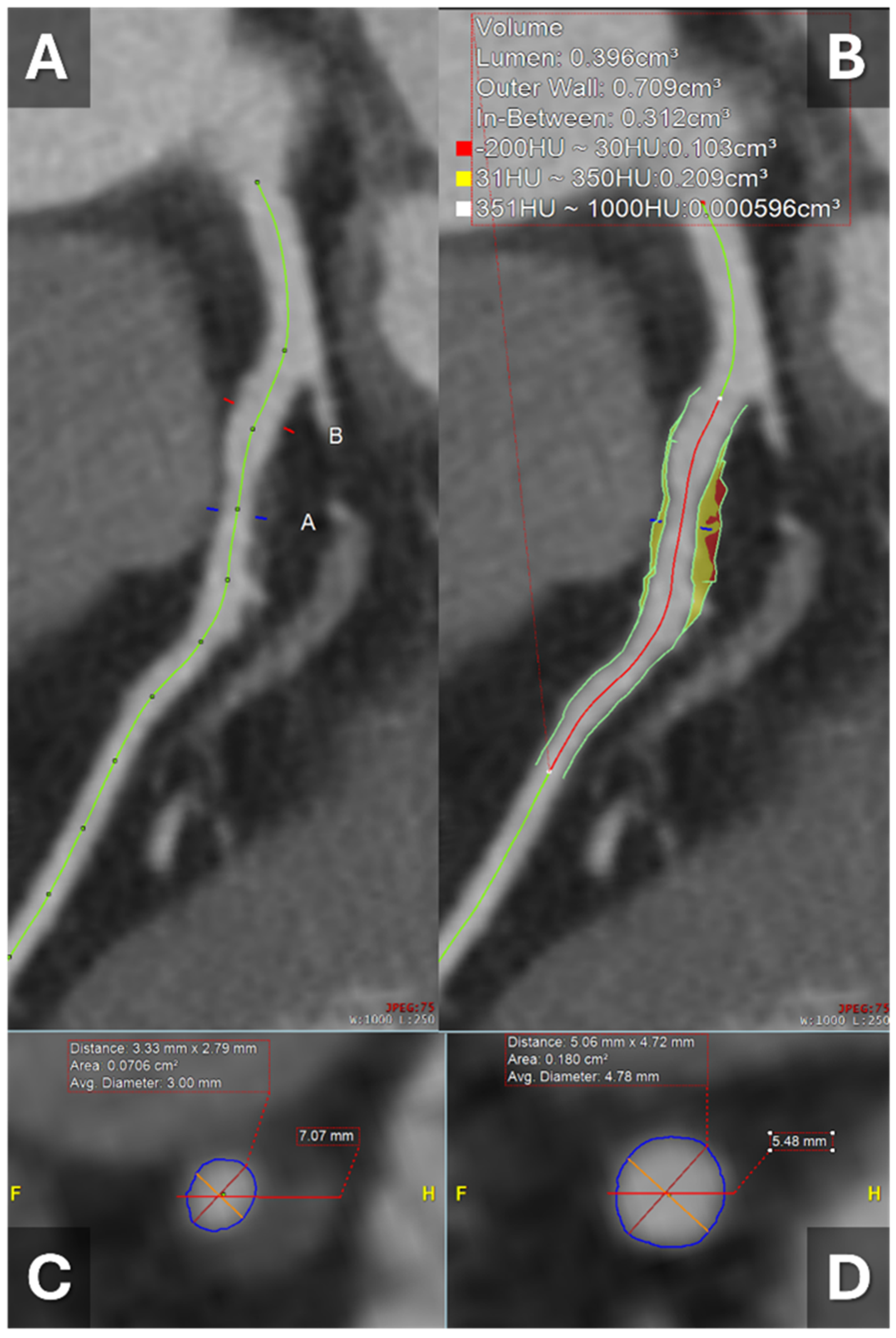 Tomography 11 00085 g003