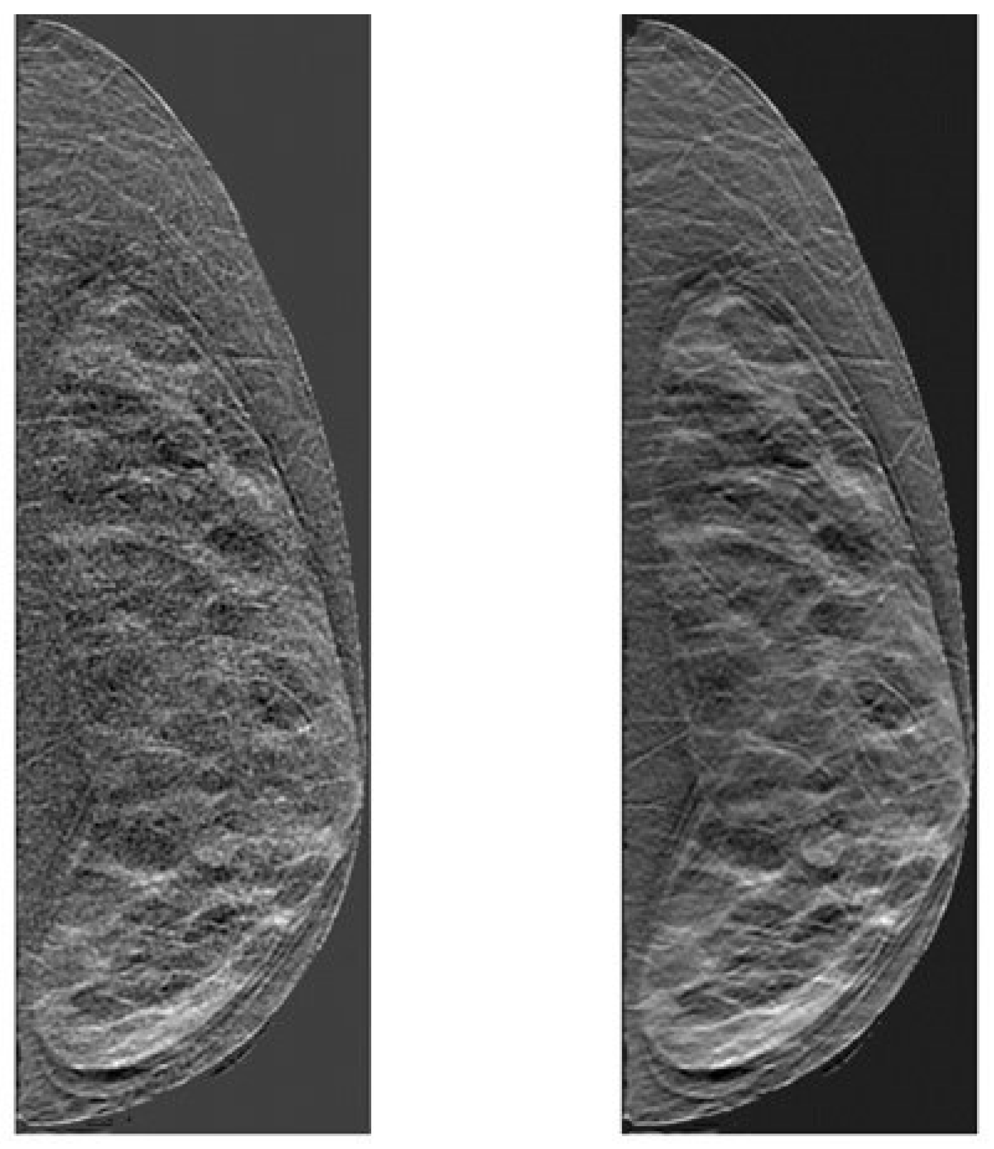 Tomography 11 00087 g002 Tomography 11 00087 g002