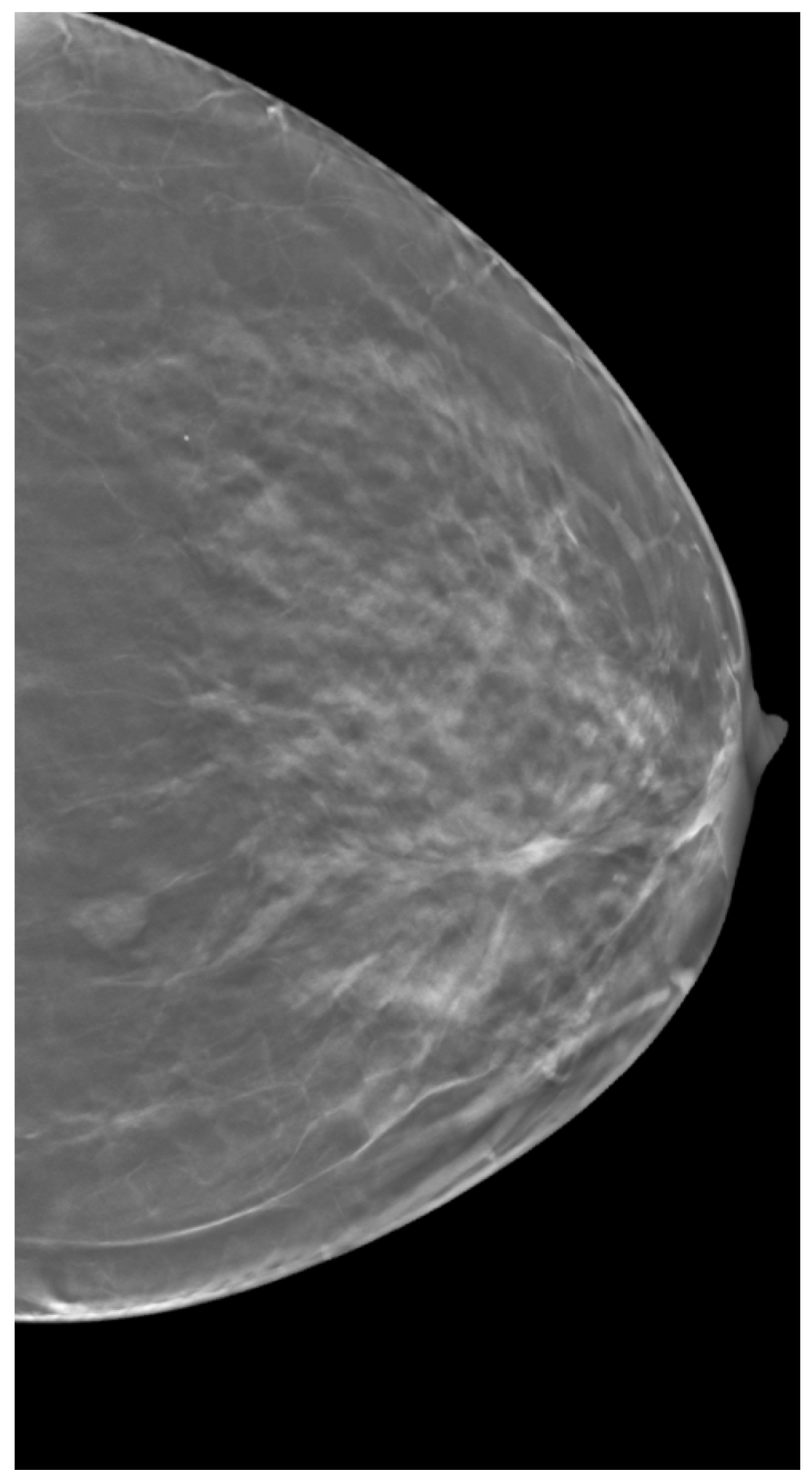 Tomography 11 00087 g003 Tomography 11 00087 g003