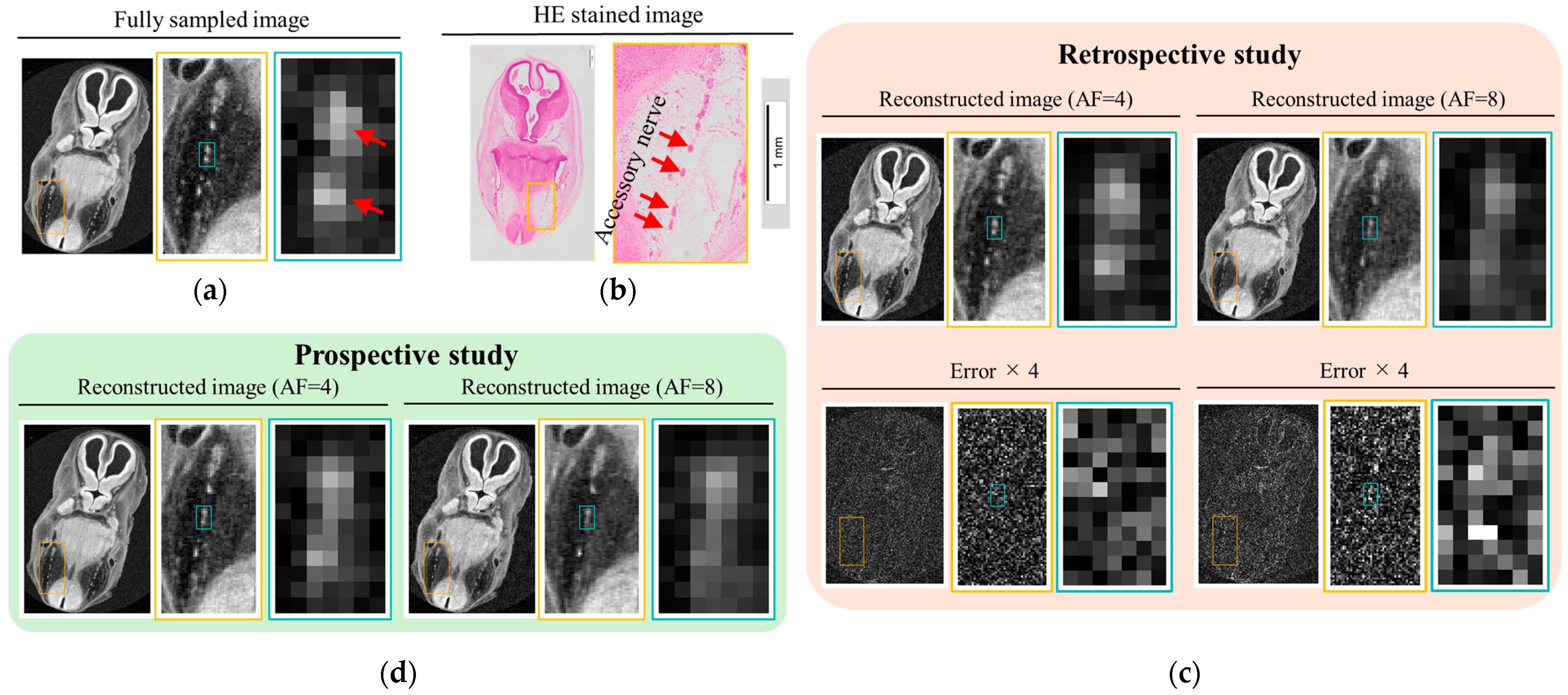 Tomography 11 00088 g009