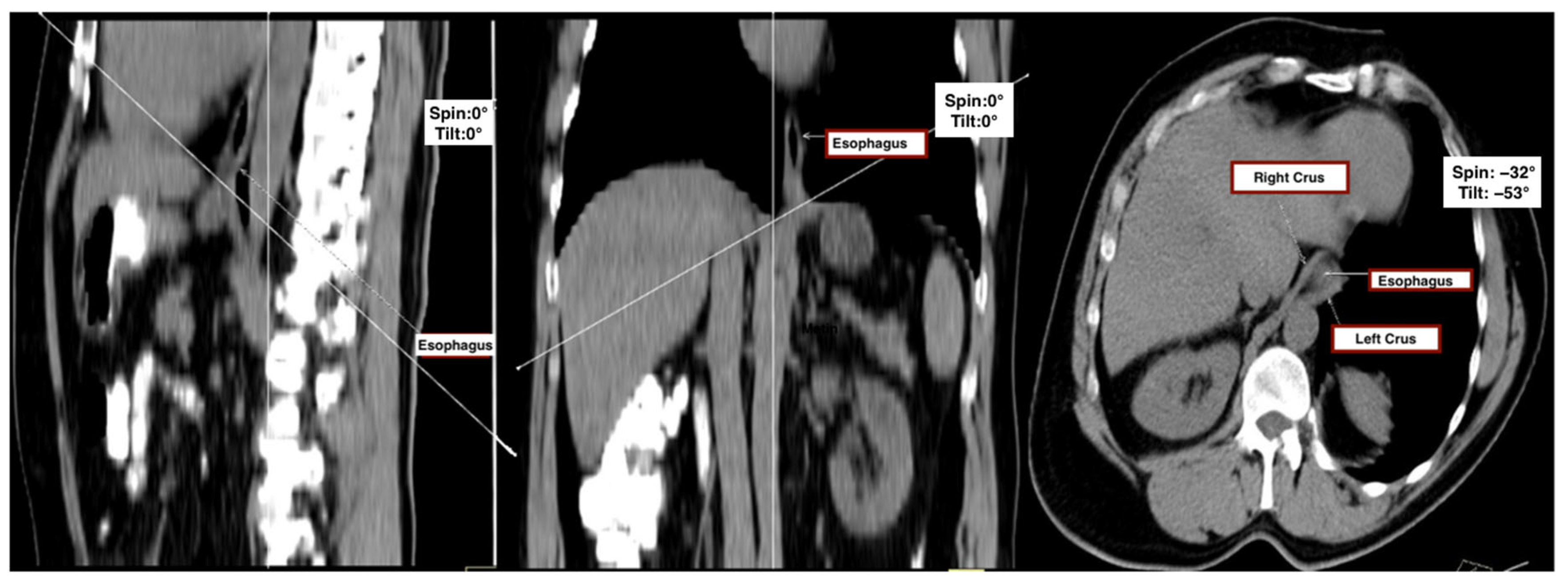 Tomography 11 00098 g001 Tomography 11 00098 g001