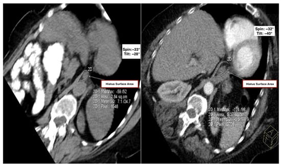Tomography 11 00098 g002