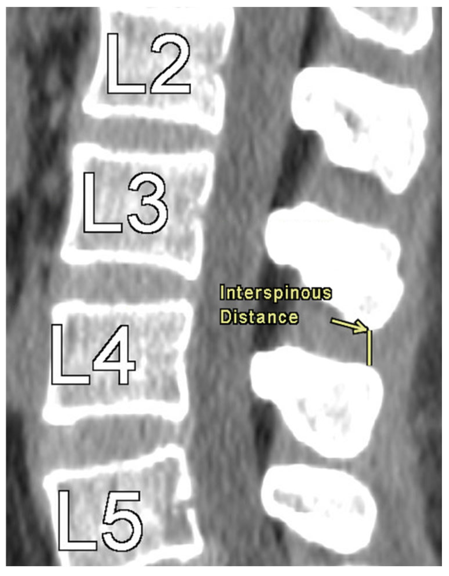 Tomography 11 00100 g001 Tomography 11 00100 g001