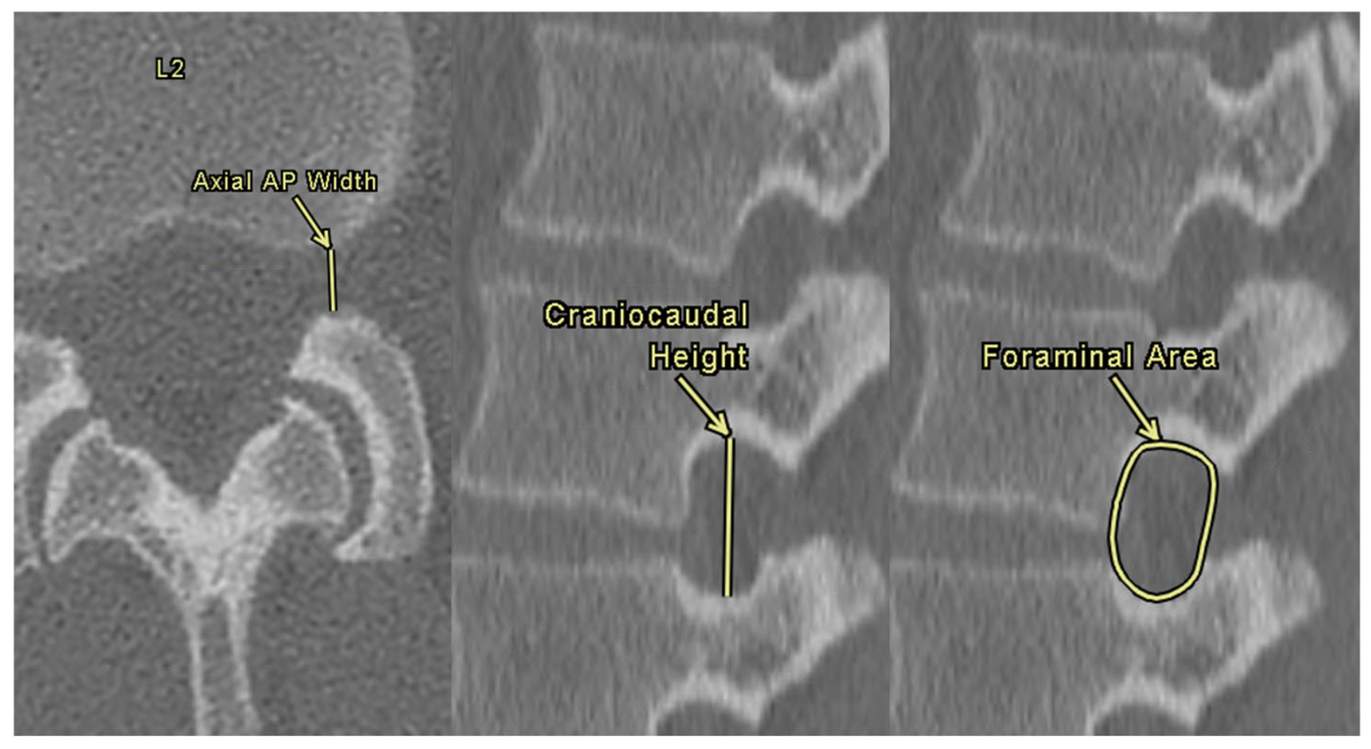 Tomography 11 00100 g003 Tomography 11 00100 g003