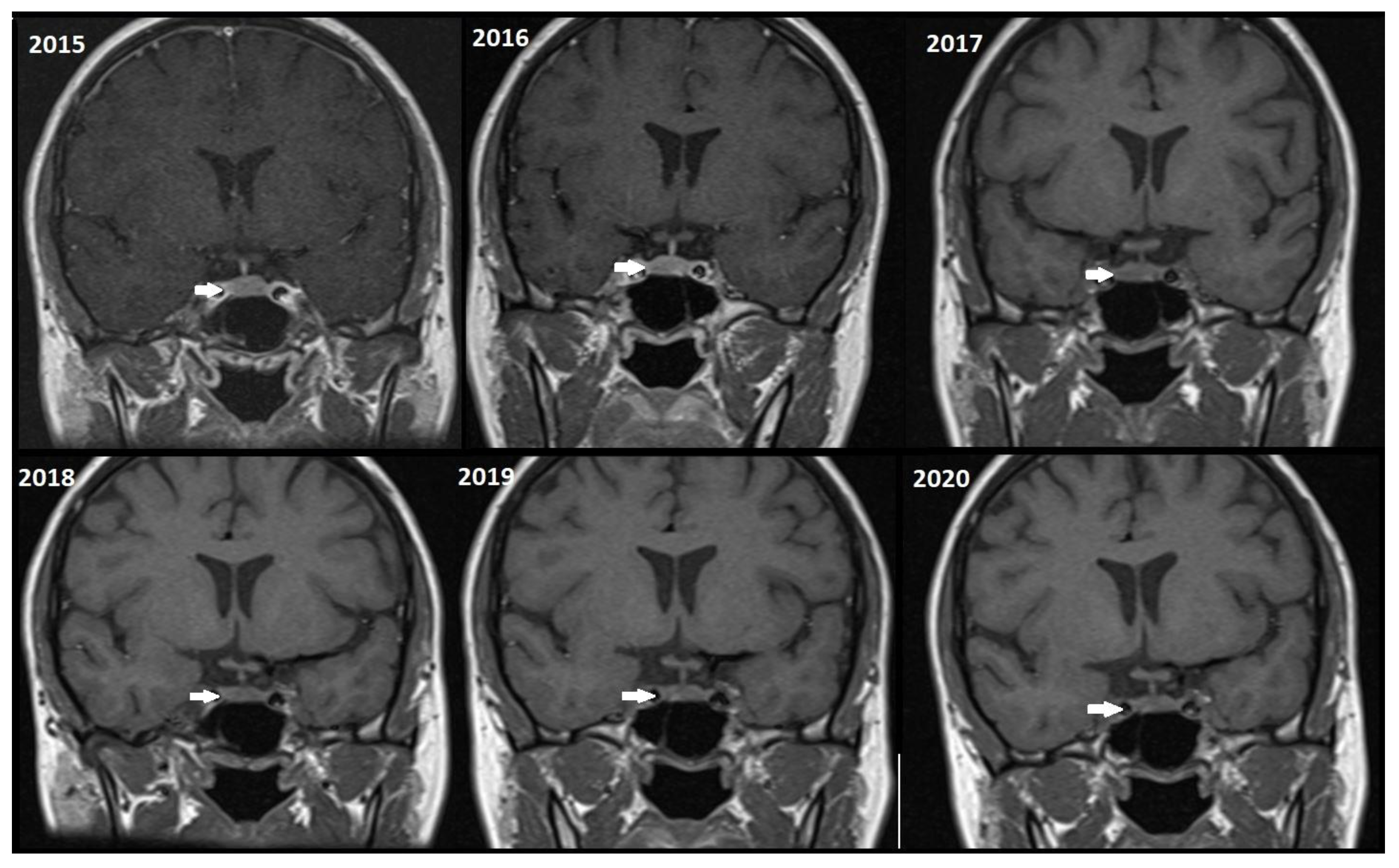 Tomography 11 00105 g003