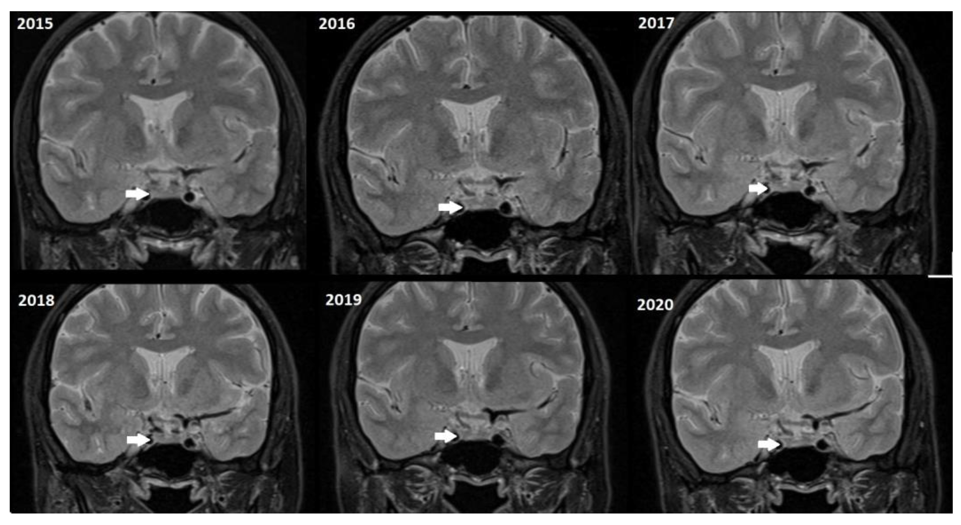 Tomography 11 00105 g004